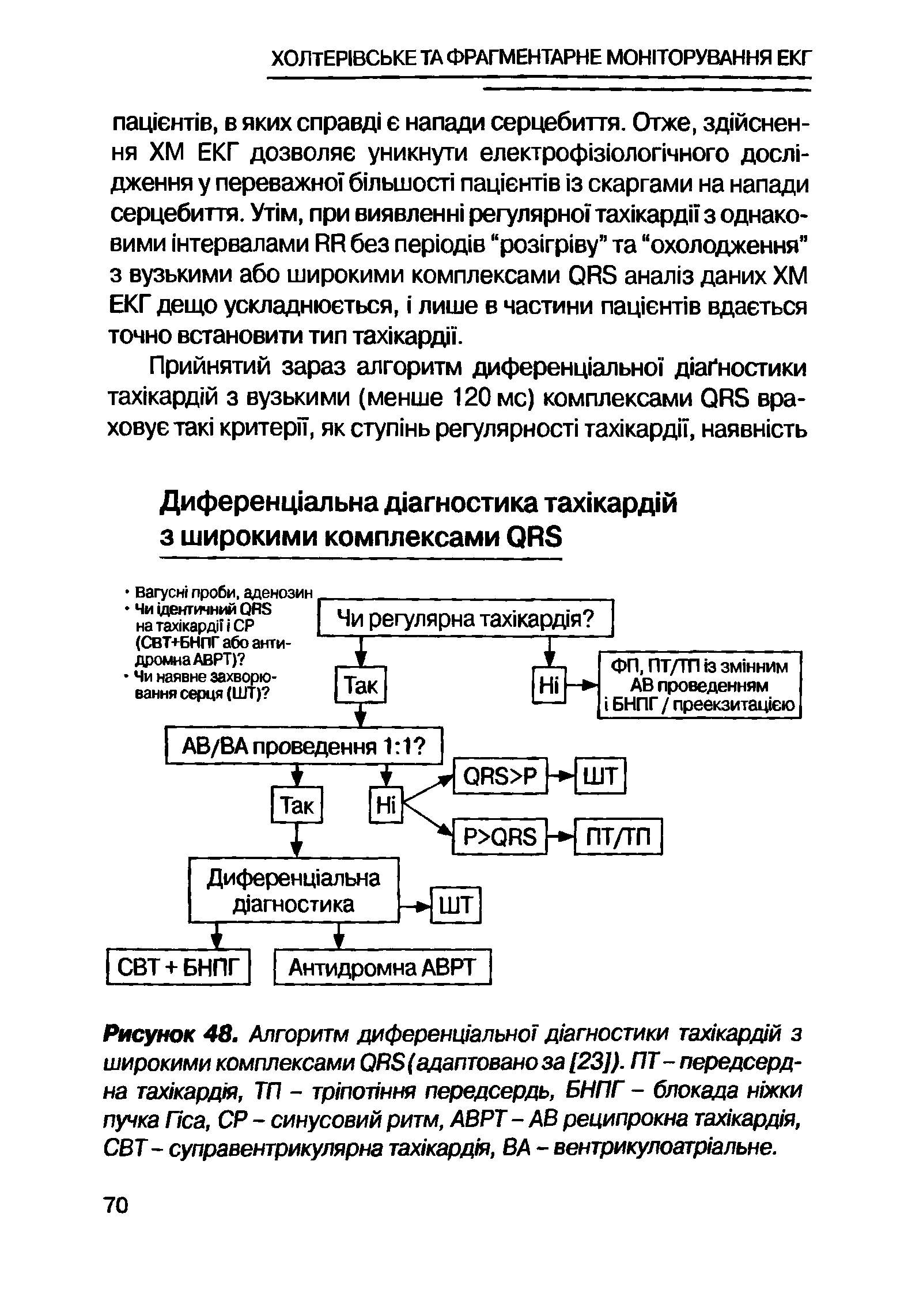 Рисунок 48. Алгоритм диференц1ально1 д гностики тамкардм з широкими комплексами ( (адаптованоза [23]). ПТ- передсерд-на тах1кард1Я, ТП - тр/попння передсердь, БНПГ - блокада нокки пучка Пса, СР - синусовий ритм, АВРТ - АВ реципрокна тамкард1Я, СВТ - суправентрикулярна тах1кард1я, ВА - вентрикулоатр/альне.