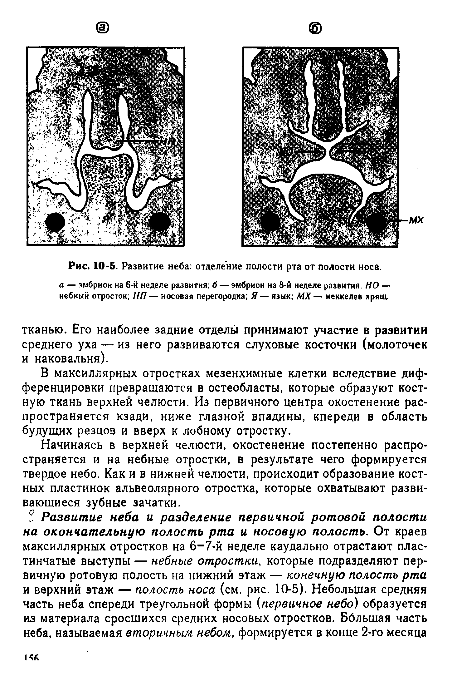 Рис. 10-5. Развитие неба отделение полости рта от полости носа. а — эмбрион на 6-й неделе развития б — эмбрион на 8-й неделе развития. НО — небный отросток НП — носовая перегородка Я — язык МХ — меккелев хрящ.