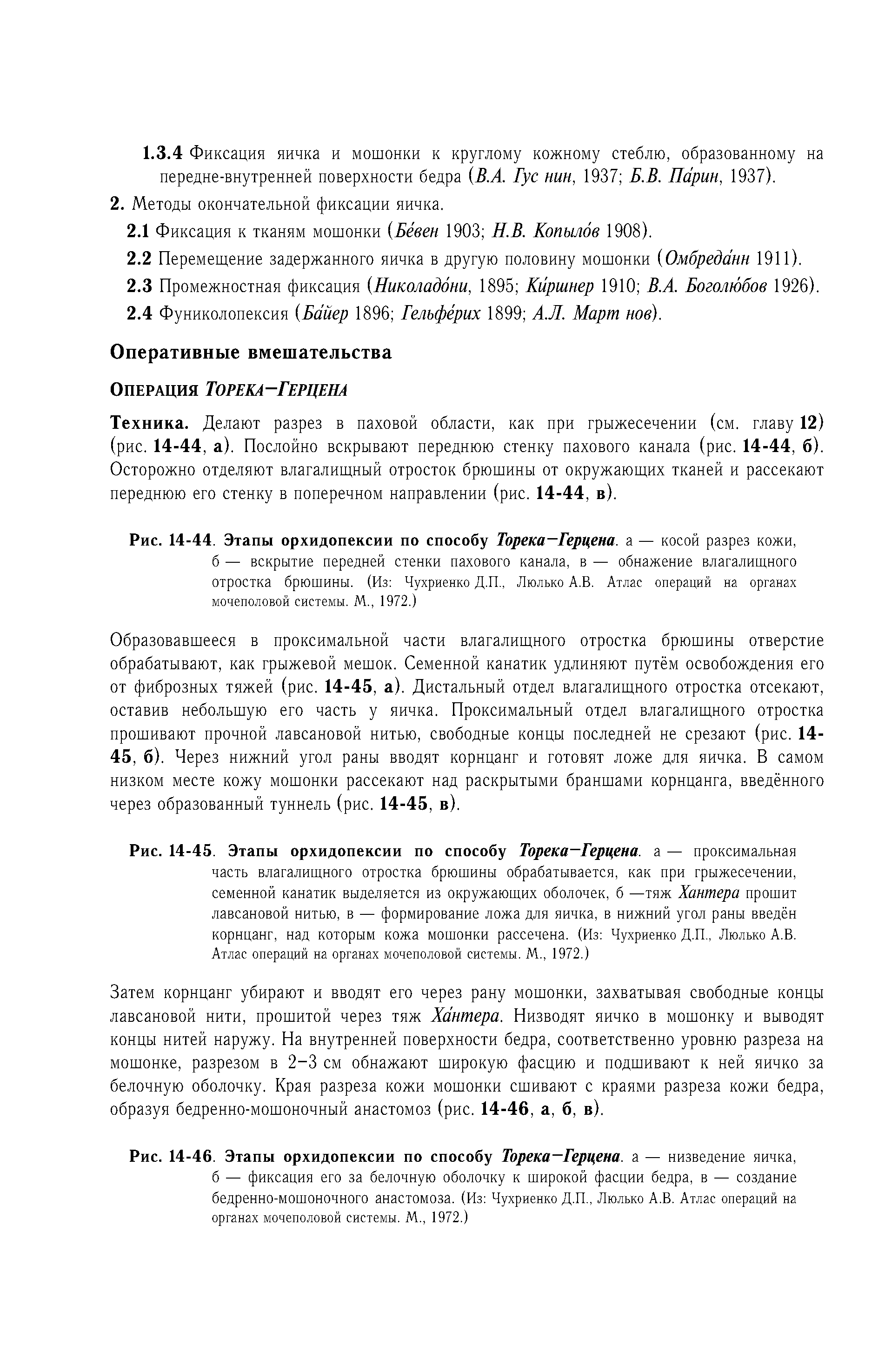 Рис. 14-46. Этапы орхидопексии по способу Торека—Герцена, а — низведение яичка,...