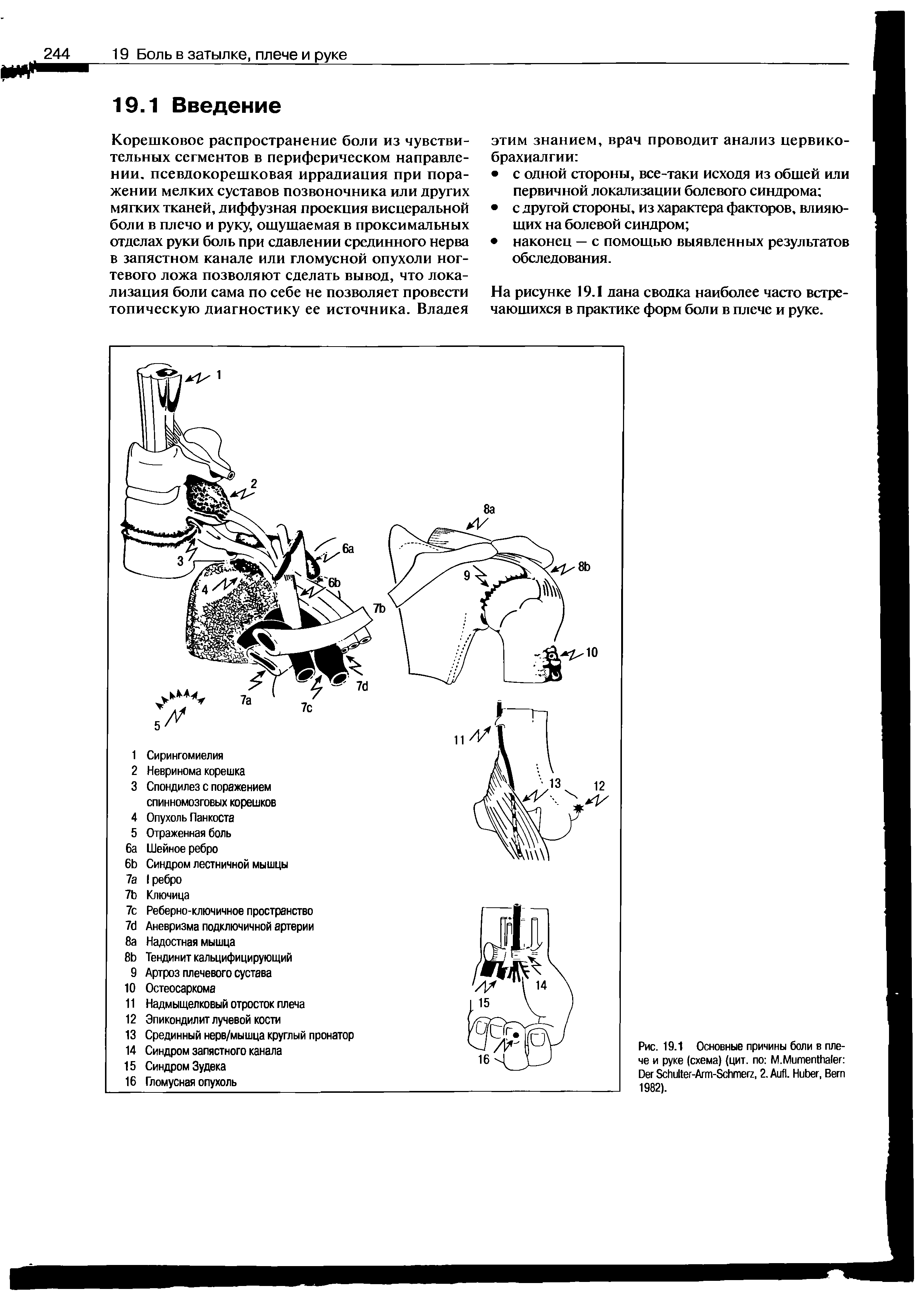 Рис. 19.1 Основные причины боли в плече и руке (схема) (цит. по M.M D S -A -S , 2. A . H , B 1982).