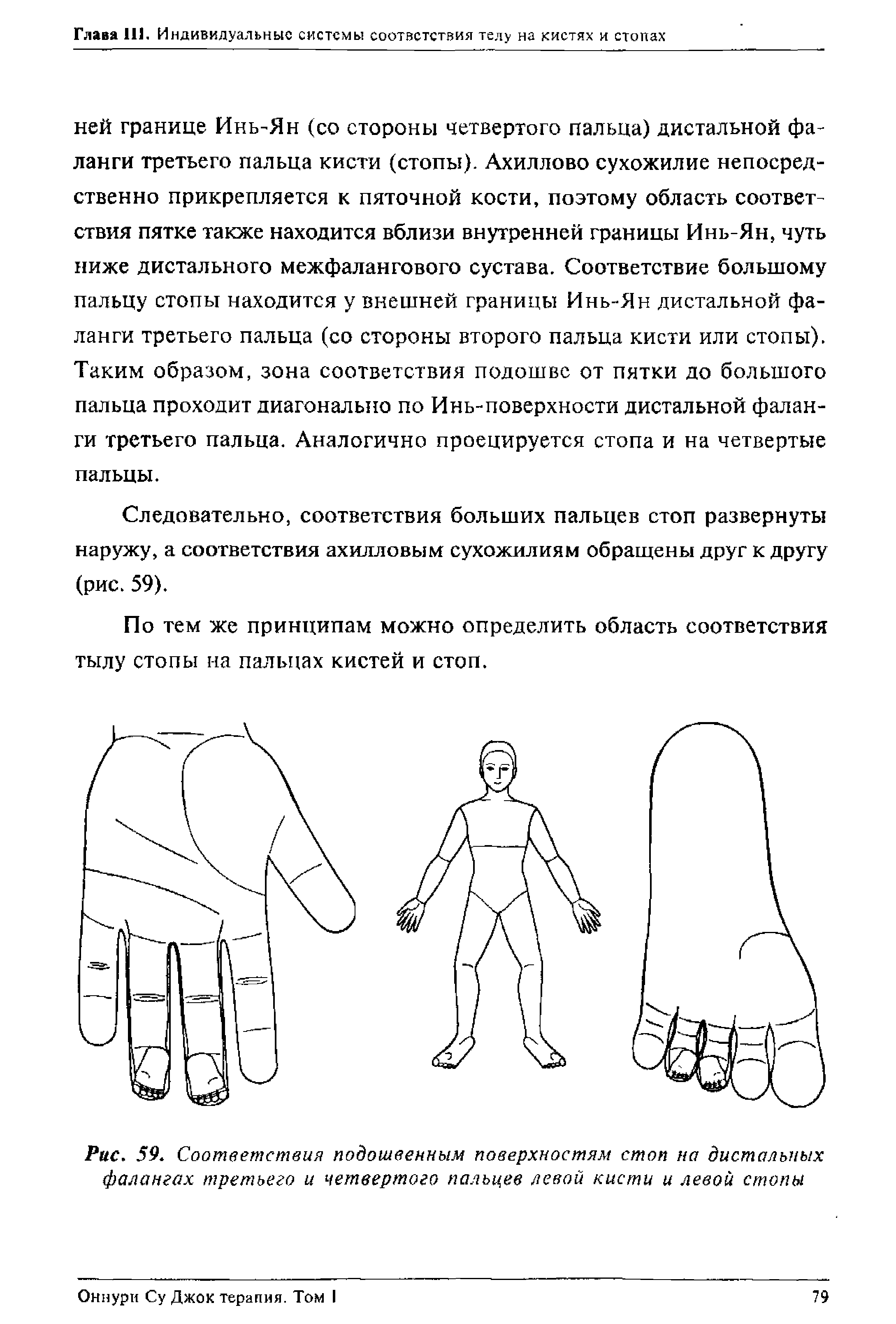 Рис. 59. Соответствия подошвенным поверхностям стоп на дистальных фалангах третьего и четвертого пальцев левой кисти и левой стопы...