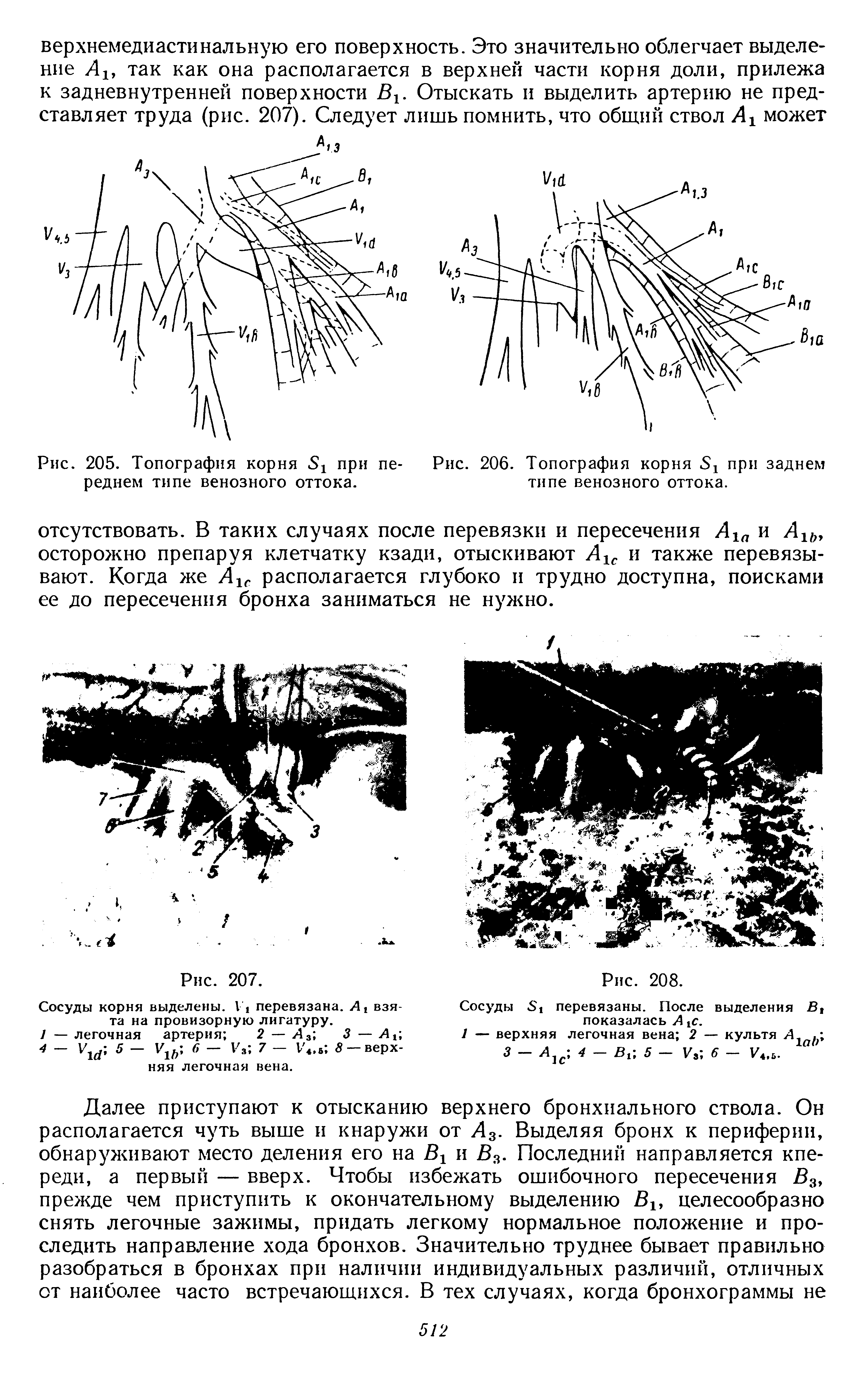 Рис. 205. Топография корня 5 при переднем типе венозного оттока.