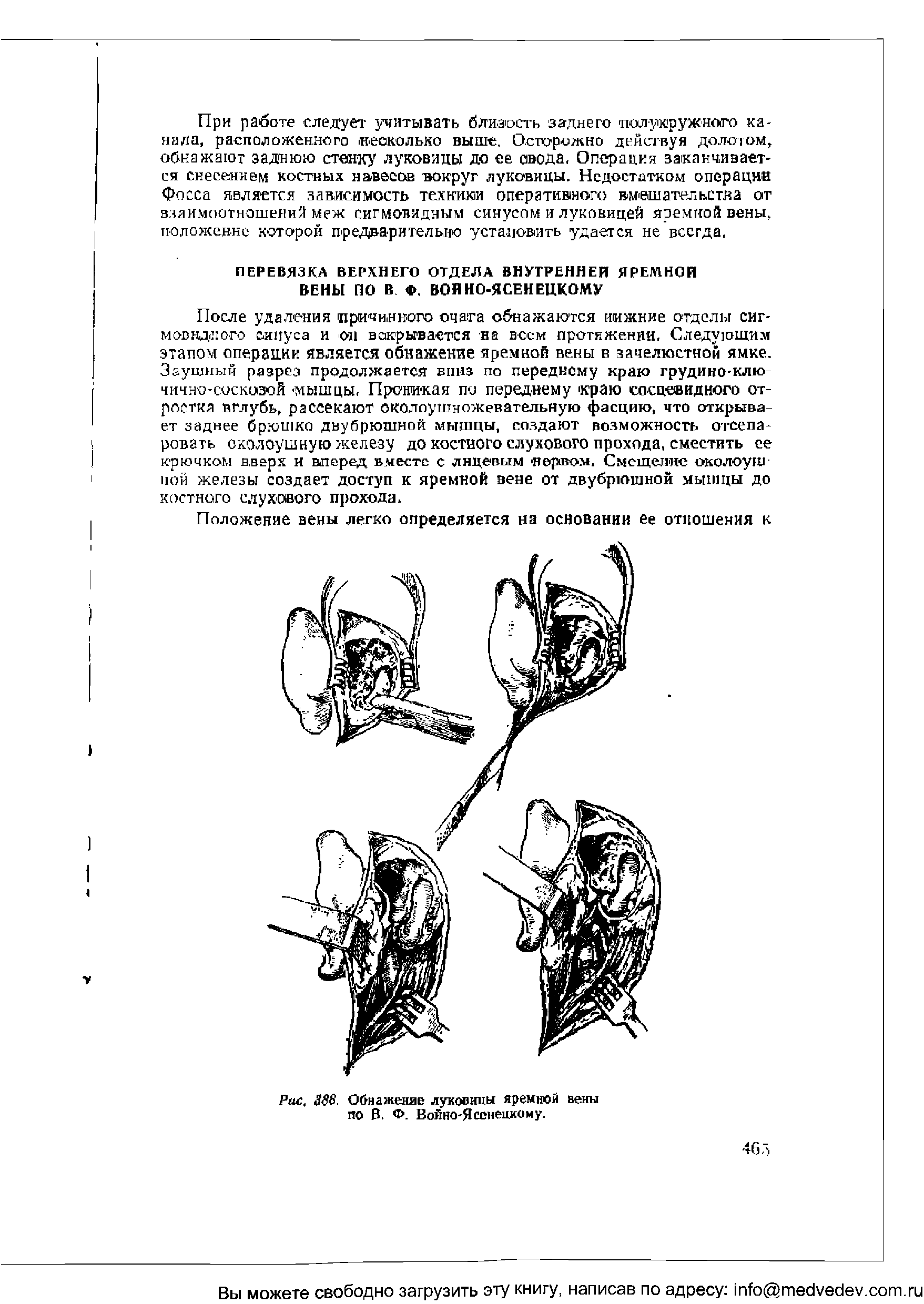 Рис. 388. Обнажение луковицы яремной вены по В. Ф. Войно-Ясененкому.