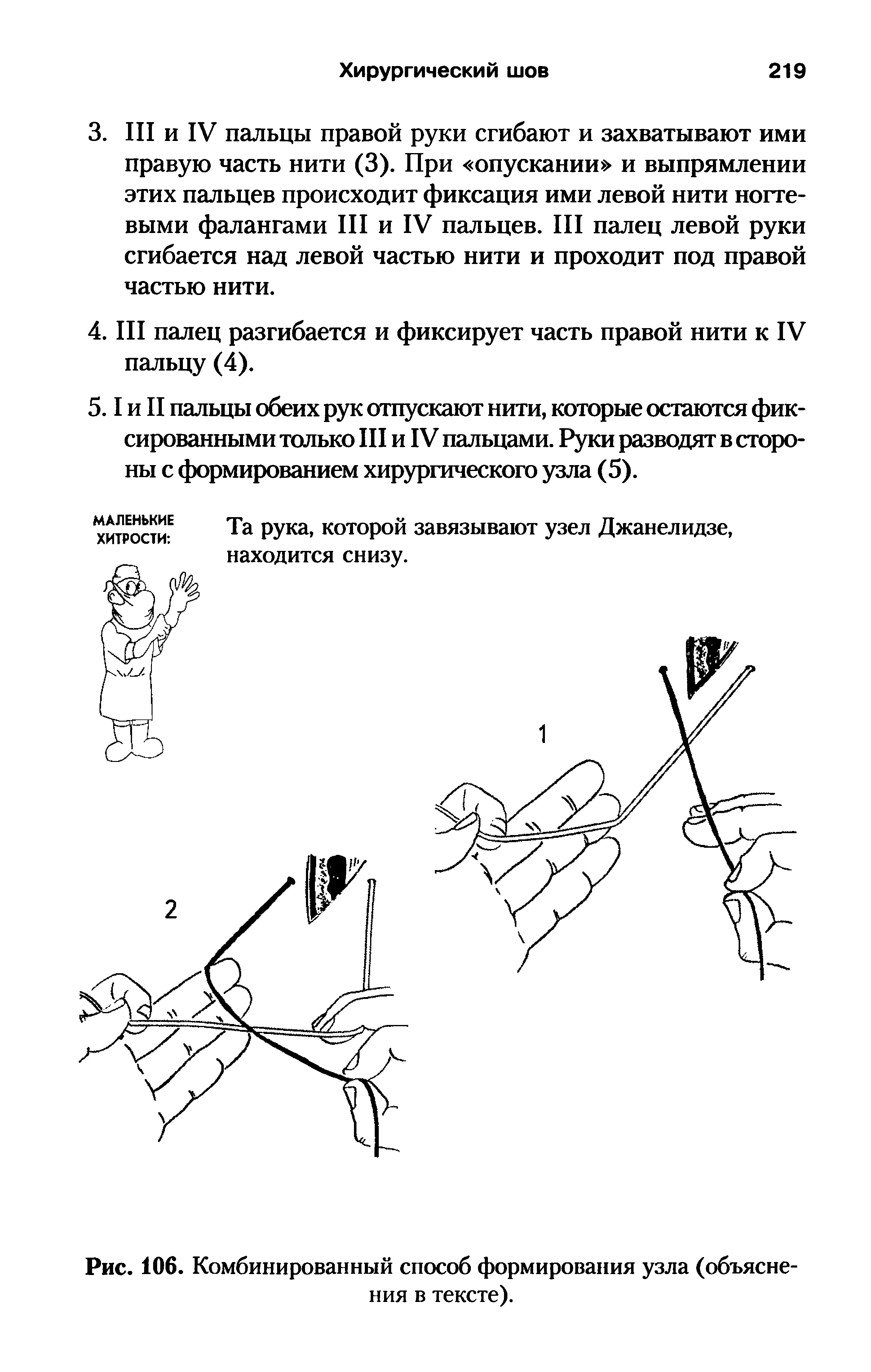 Рис. 106. Комбинированный способ формирования узла (объяснения в тексте).