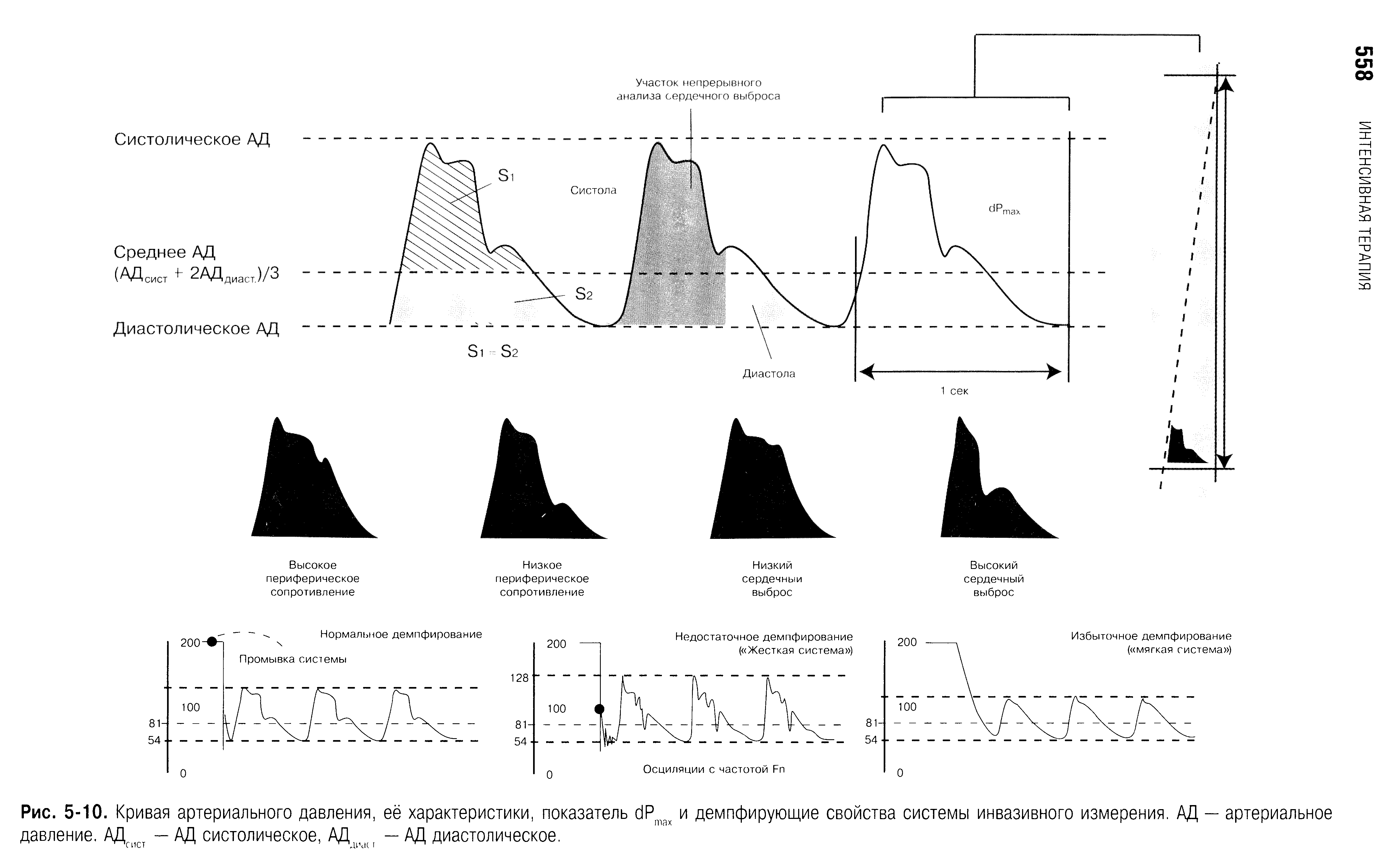 Рис. 5-10. Кривая артериального давления, её характеристики, показатель с1Ртах и демпфирующие свойства системы инвазивного измерения. АД — артериальное давление. АДсист — АД систолическое, АДьмн — АД диастолическое.