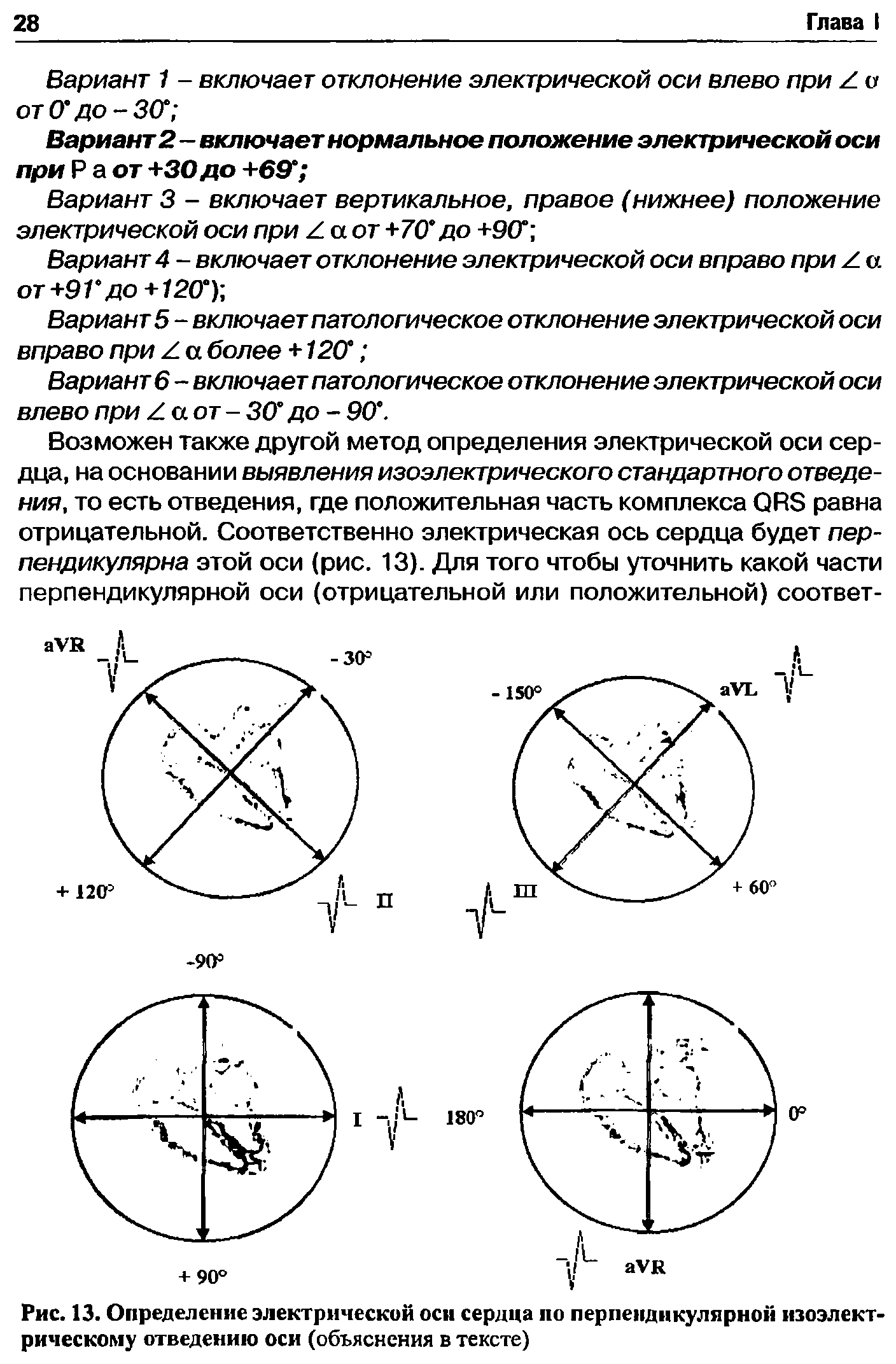 Рис. 13. Определение электрической оси сердца ио перпендикулярной изоэлектрическому отведению оси (объяснения в тексте)...