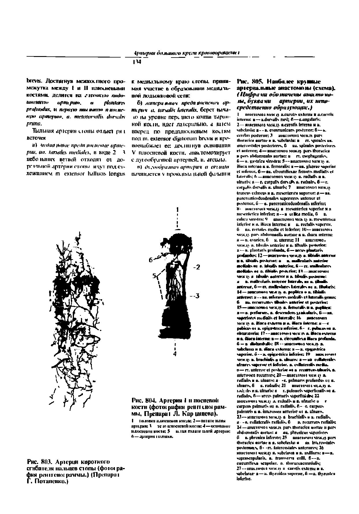 Рис. 803. Артерии короткого сгибателя пальцев стопы (фою1 рафия раммы.) (Преп-ар-л Г. Потапенко.)...