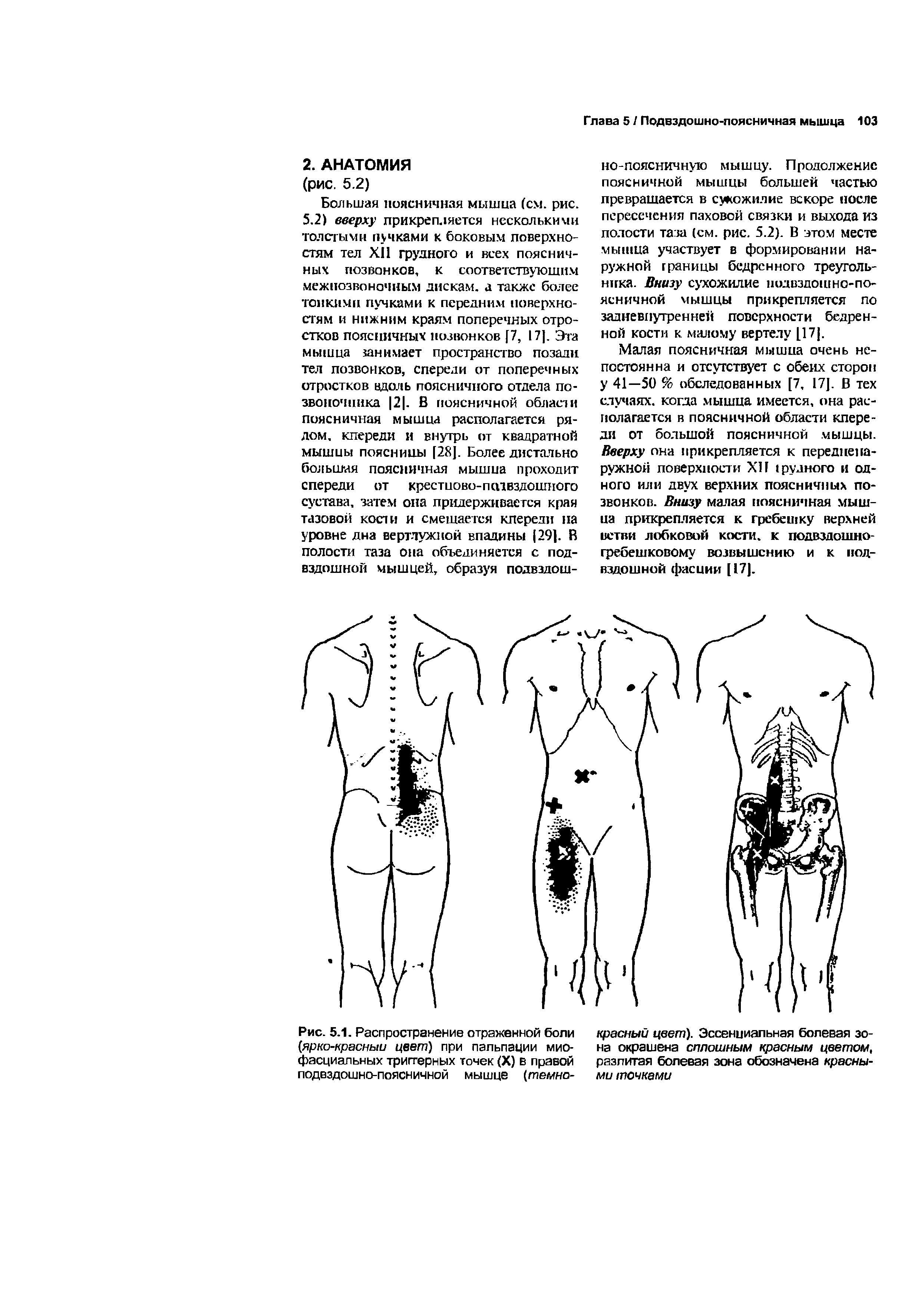 Рис. 5.1. Распространение отраженной боли (ярко-красный цвет) при пальпации миофасциальных триггерных точек (X) в правой подвздошно-поясничной мышце (темно...