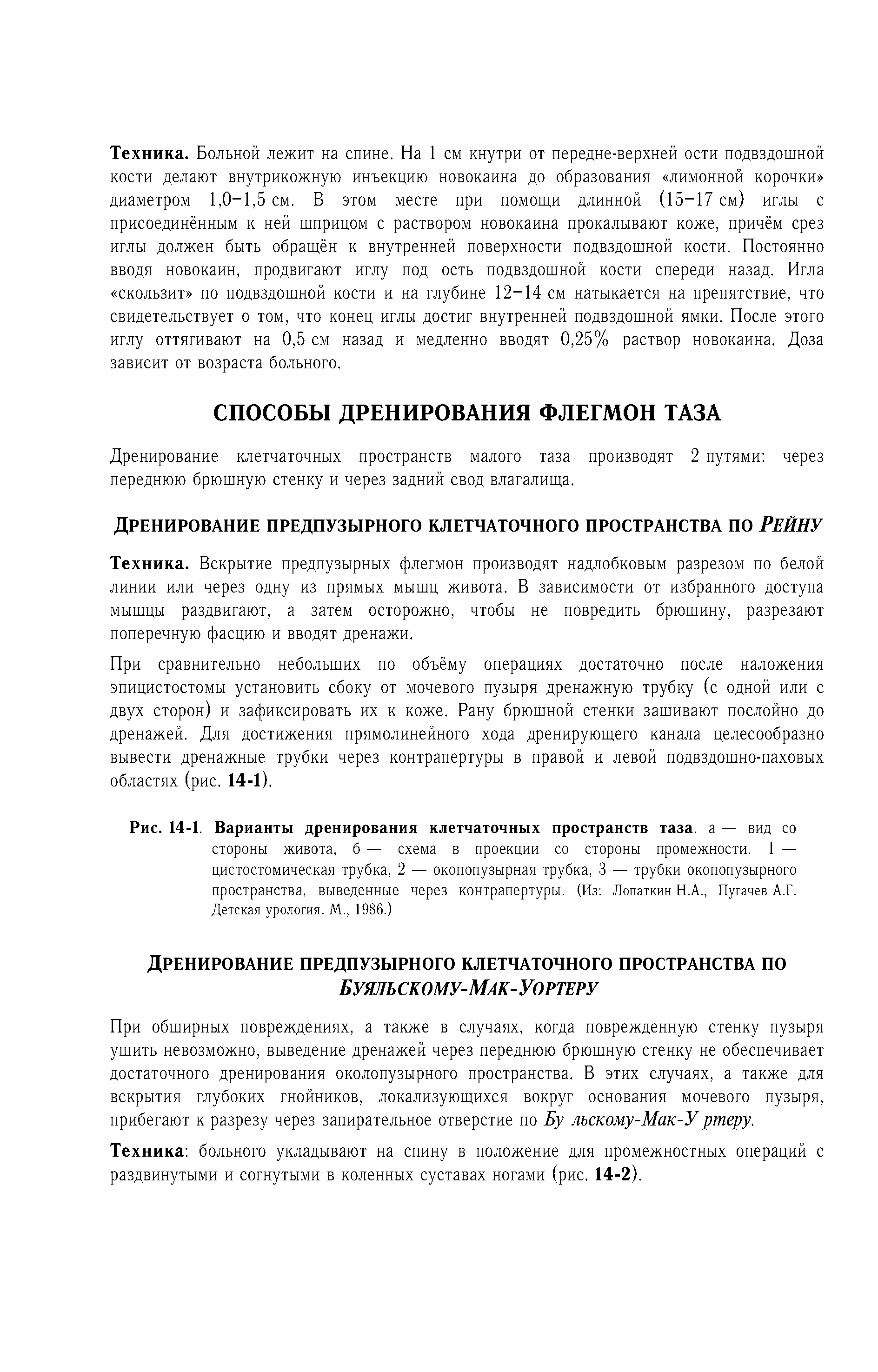 Рис. 14-1. Варианты дренирования клетчаточных пространств таза, а — вид со стороны живота, б — схема в проекции со стороны промежности. 1 — цистостомическая трубка, 2 — окопопузырная трубка, 3 — трубки окопопузырного пространства, выведенные через контрапертуры. (Из Лопаткин Н.А., Пугачев А.Г. Детская урология. М., 1986.)...