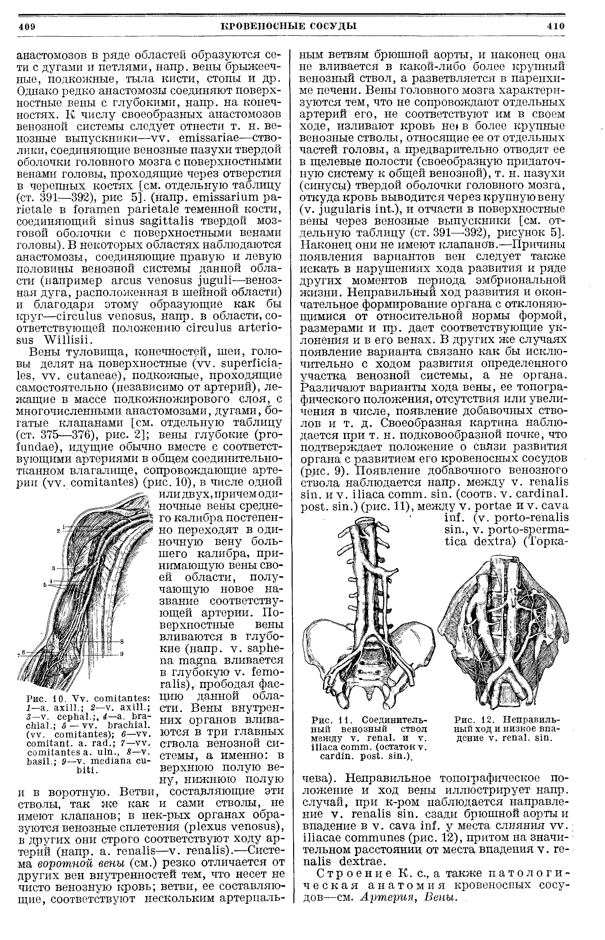 Рис. 11. Соединительный венозный ствол между V. , и . , (остаток . . . .).