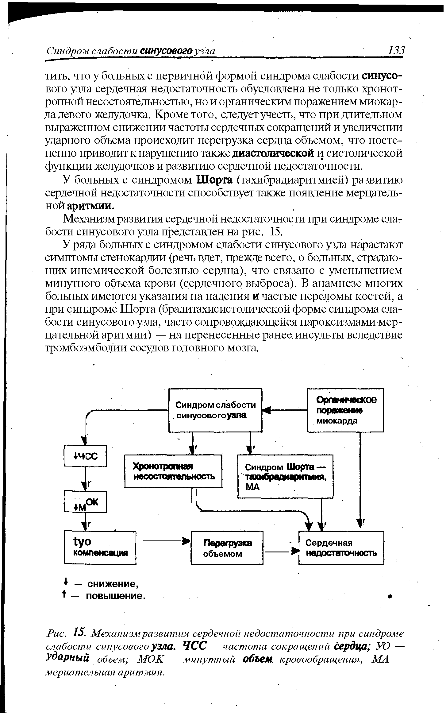 Рис. 15. Механизм развития сердечной недостаточности при синдроме слабости синусового узла. ЧСС— частота сокращений сердца УО — Ударный объем МОК — минутный объем кровообращения, МА — мерцательная аритмия.