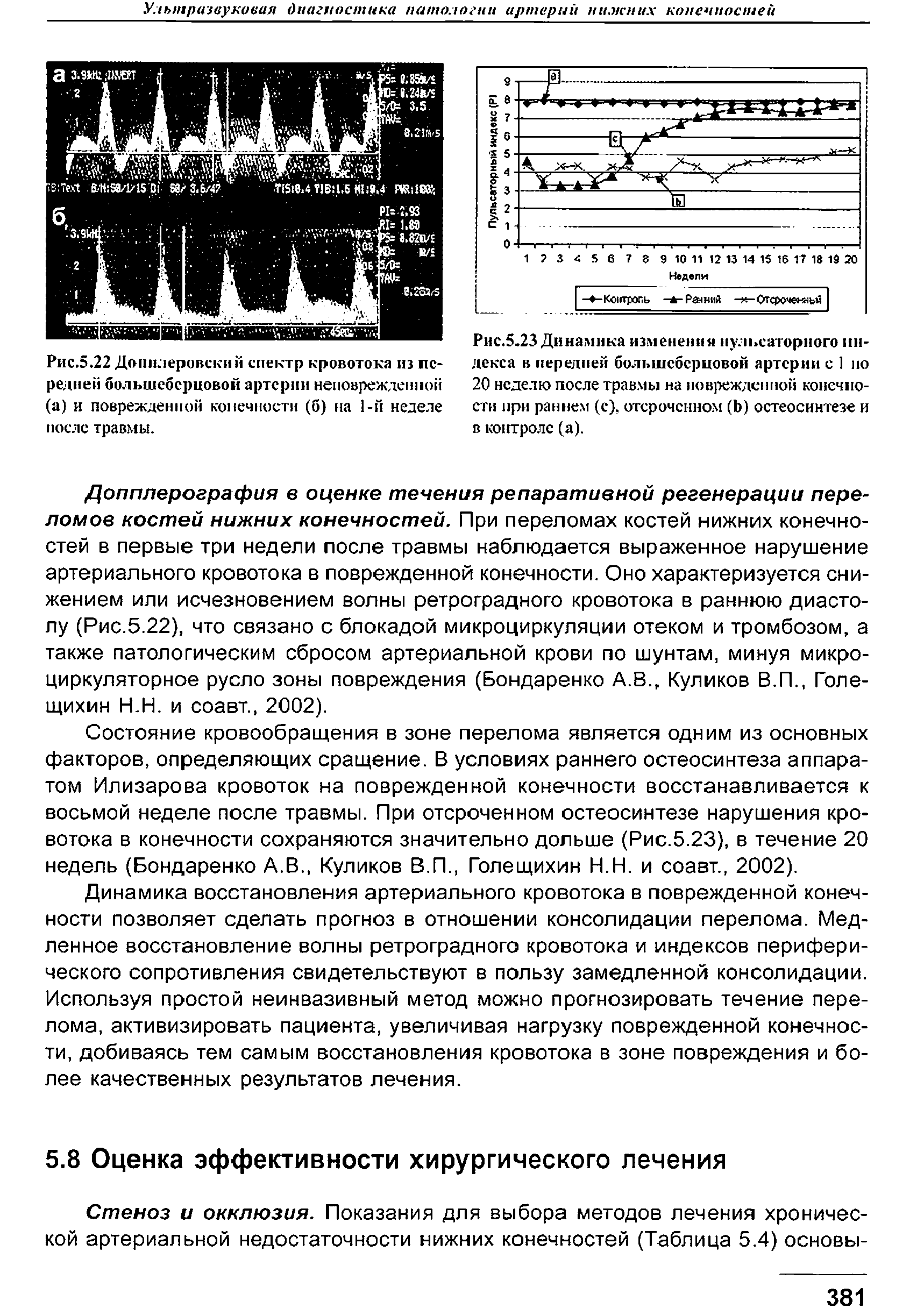 Рис.5.23 Динамика изменения пульсаторного индекса в передней большеберцовой артерии с 1 ио 20 неделю после травмы на поврежденной конечности при раннем (с), отсроченном (Ь) остеосинтезе и в контроле (а).