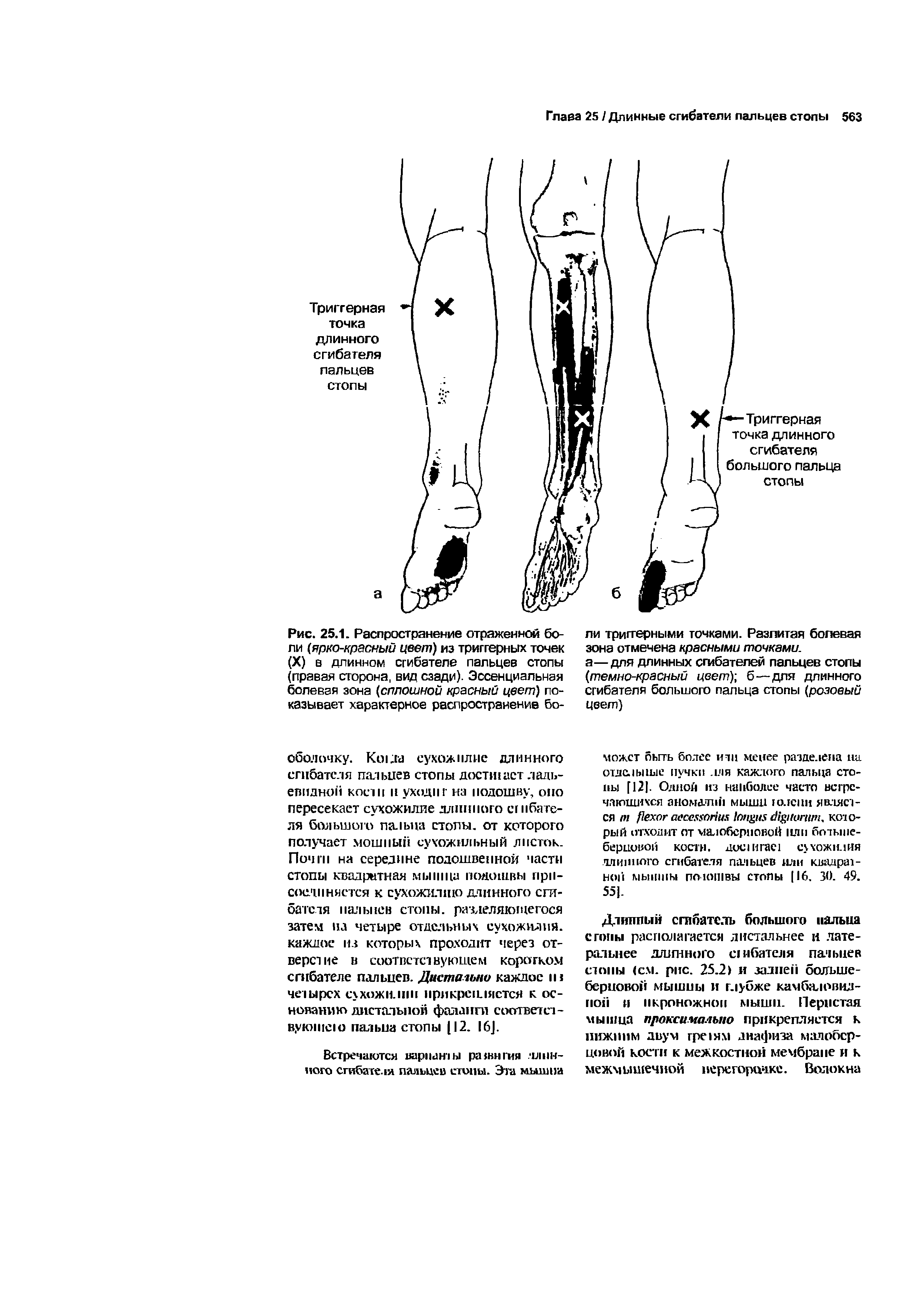 Рис. 25.1. Распространение отраженной боли (ярко-красный цвет) из триггерных точек (X) в длинном сгибателе пальцев стопы (правая сторона, вид сзади). Эссенциальная болевая зона (сплошной красный цвет) показывает характерное распространение бо...