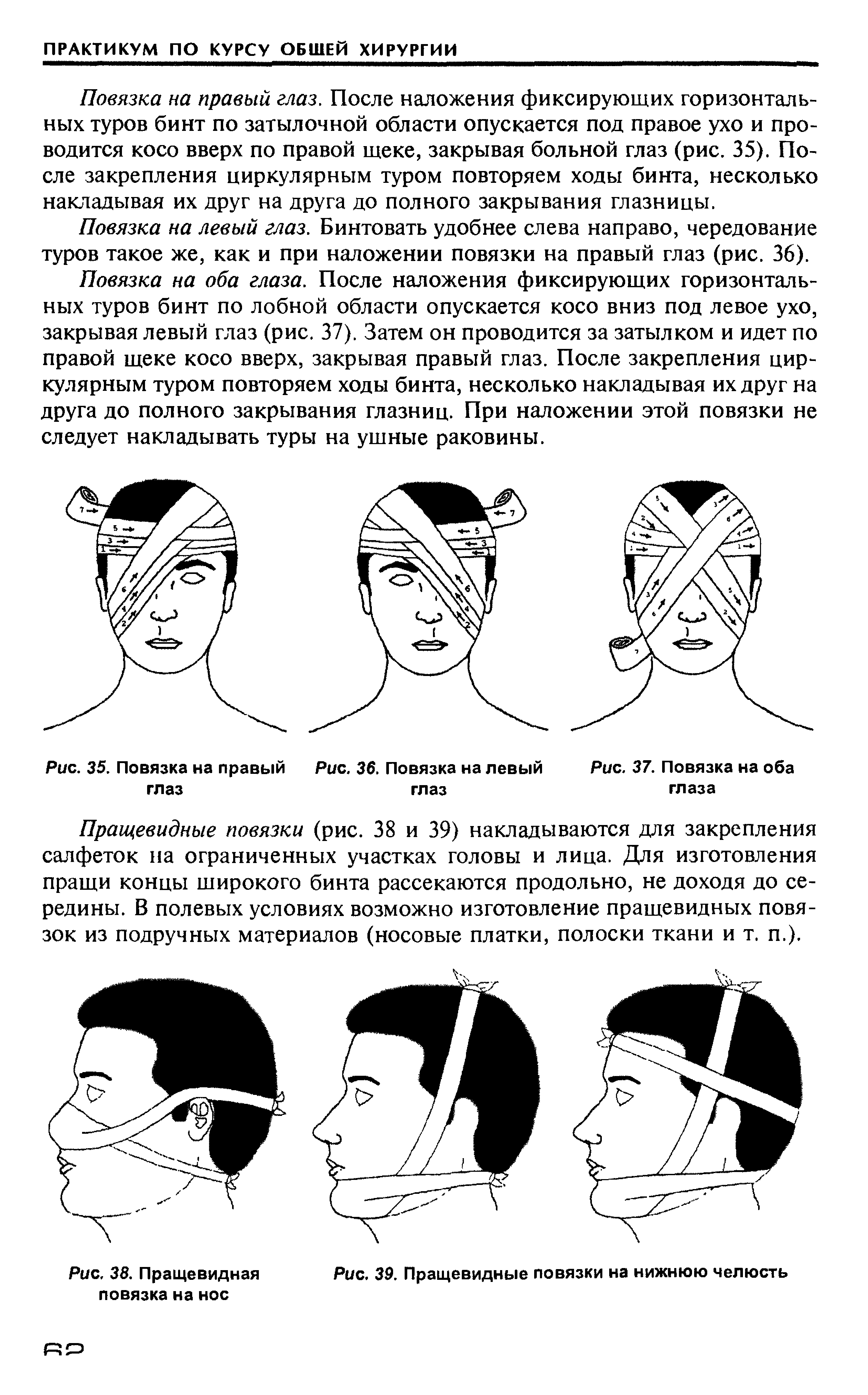 Рис. 35. Повязка на правый Рис. 36. Повязка на левый глаз глаз...