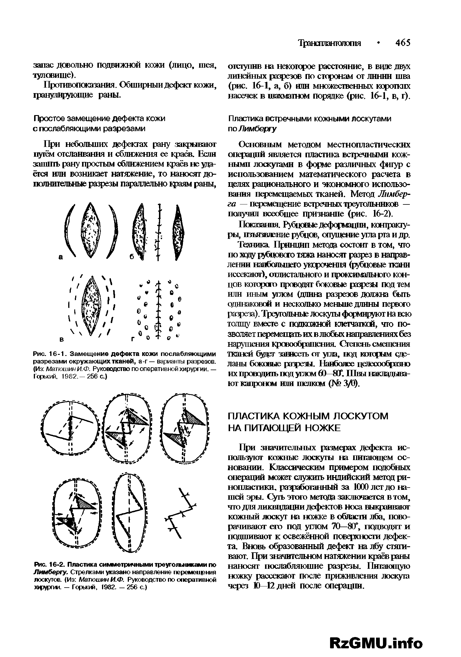 Рис. 16-1. Замещение дефекта кожи послабляющими разрезами окружающих тканей, а-г— варианты разрезов. (Из Матюшин И.Ф. Руководство по оперативной хирургии. — Горький. 1982,—256 с.)...