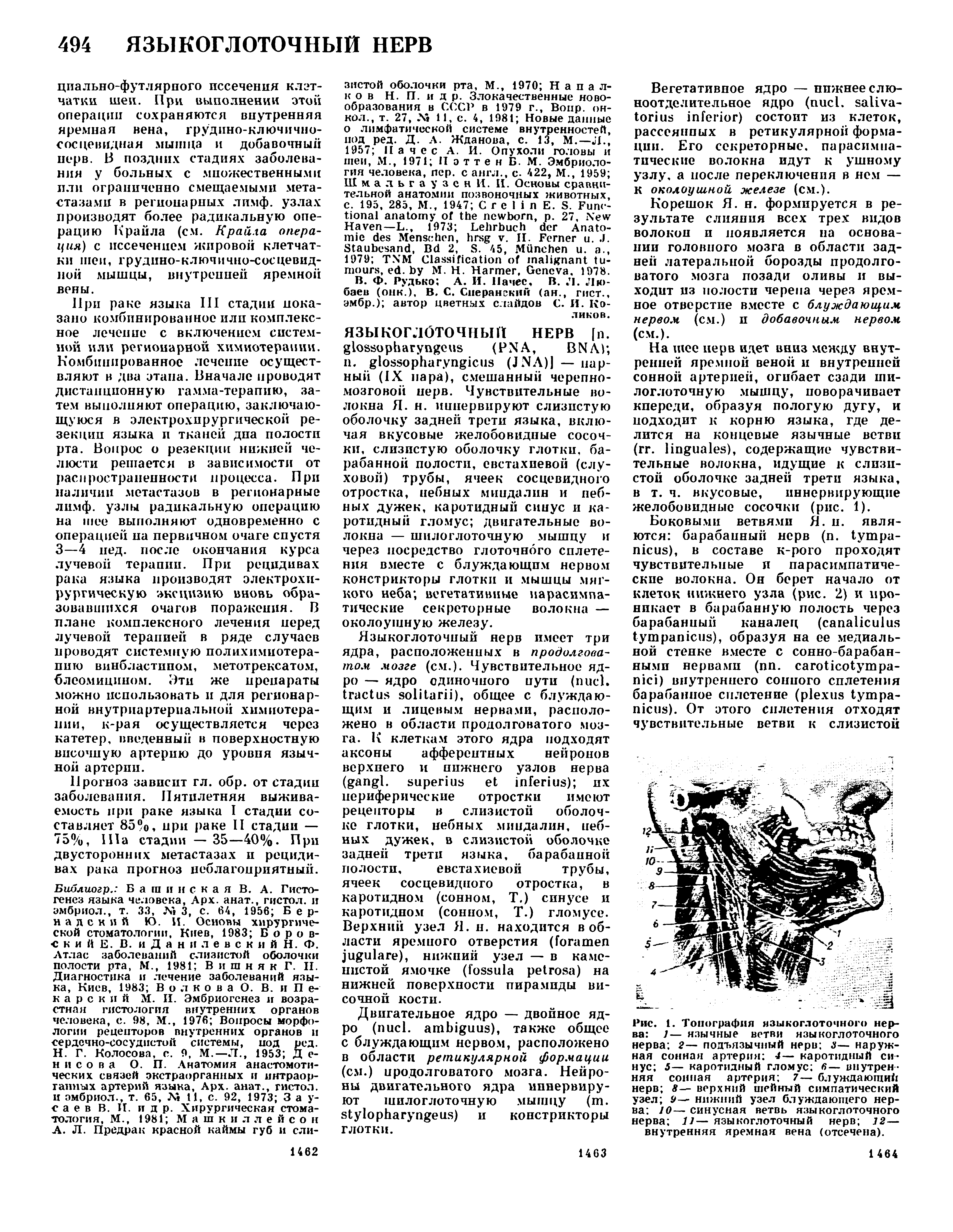 Рис. 1. Топография языкоглоточного нерва 1— язычные ветви языкоглоточного нерва 2— подъязычный нерв з— наружная сонная артерия 4— каротидный синус 5— каротидный гломус в— внутренняя сонная артерия 7— блуждающий нерв 8— верхний шейный симпатический узел 9 нижпий узел блуждающего нерва 10— синусная ветвь языкоглоточного нерва 11— языкоглоточный нерв 12— внутренняя яремная вена (отсечена).