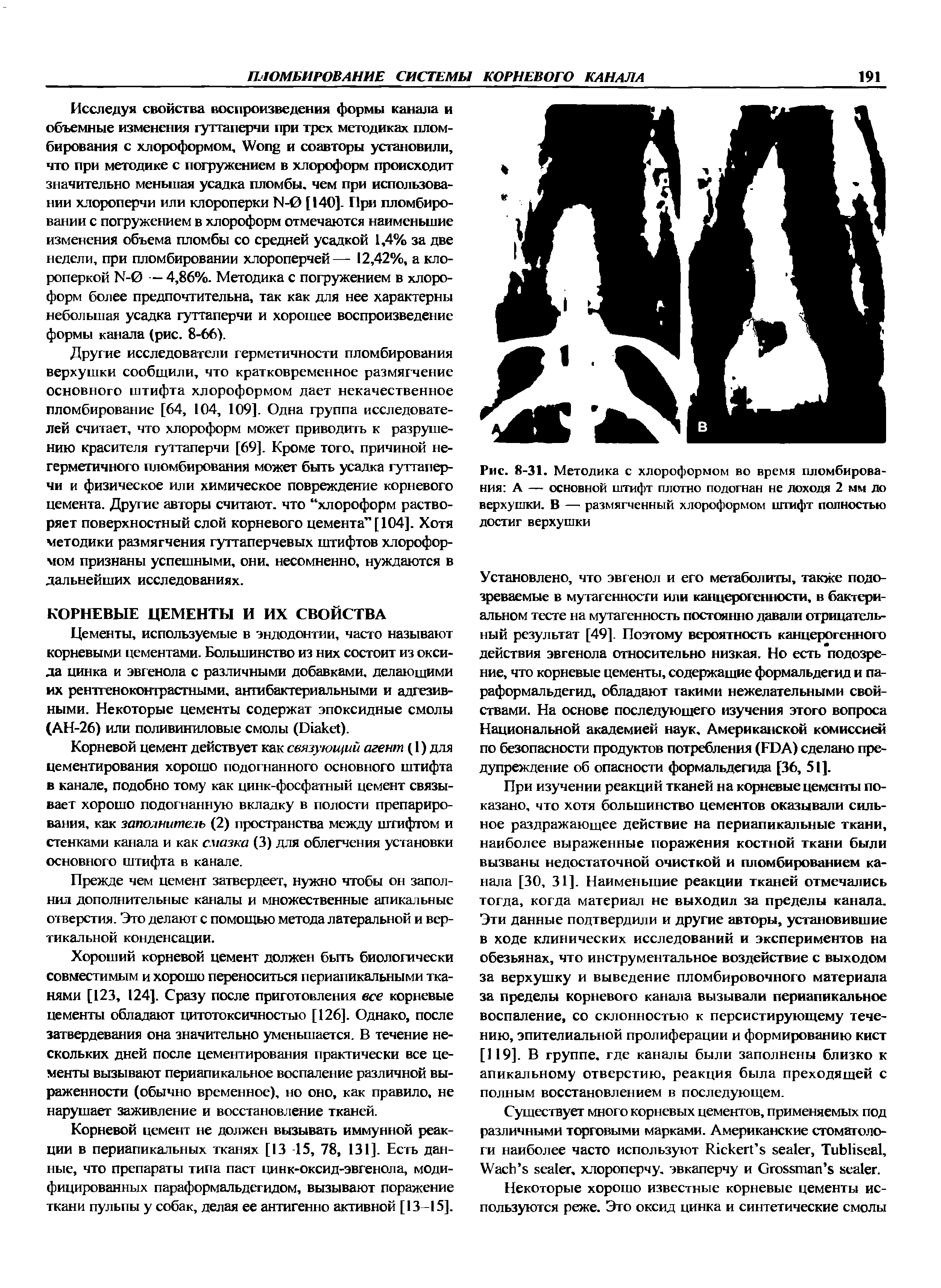 Рис. 8-31. Методика с хлороформом во время пломбирования А — основной штифт плотно подогнан не доходя 2 мм до верхушки. В — размягченный хлороформом штифт полностью достиг верхушки...