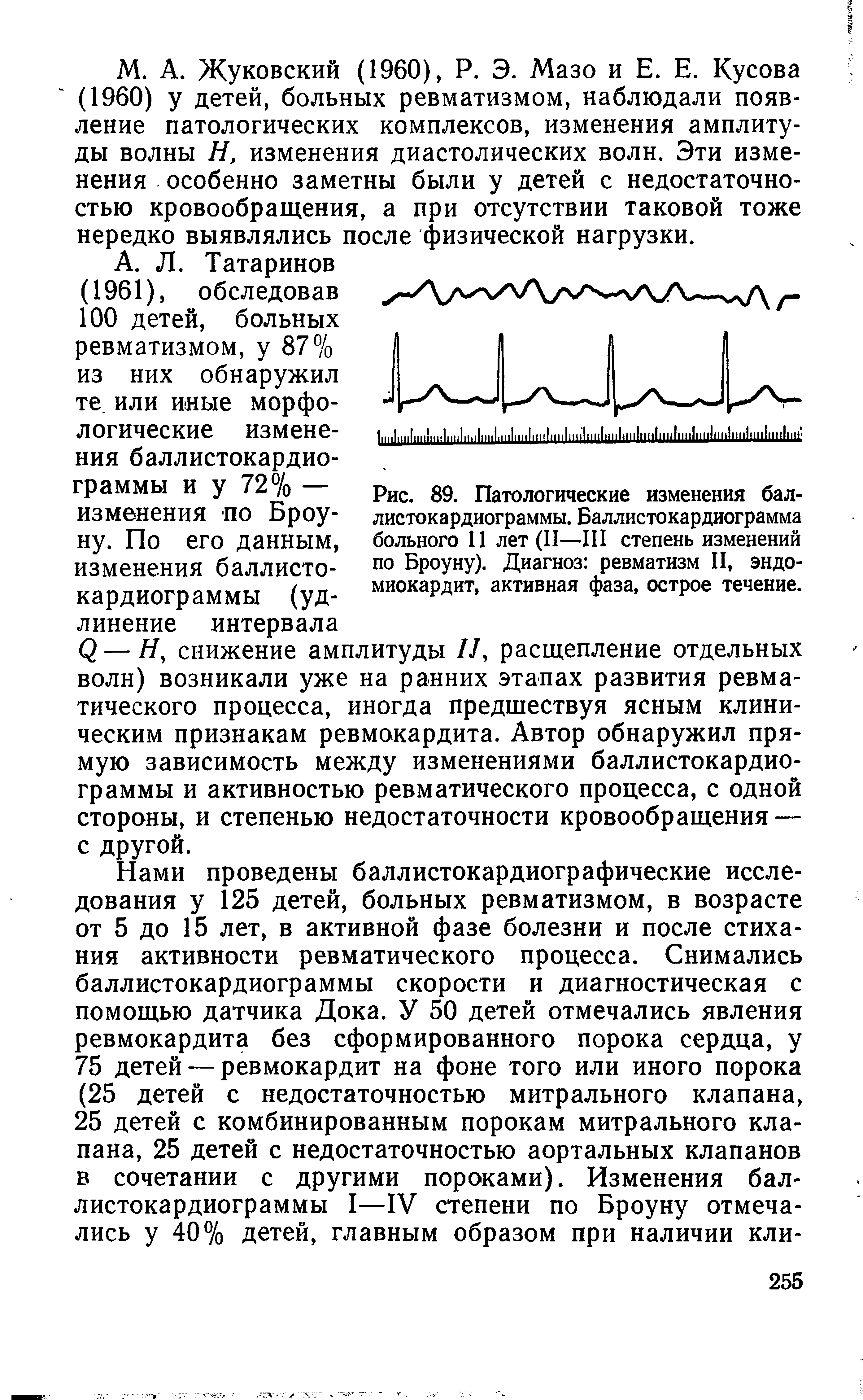 Рис. 89. Патологические изменения бал-листокардиограммы. Баллистокардиограмма больного 11 лет (II—III степень изменений по Броуну). Диагноз ревматизм II, эндомиокардит, активная фаза, острое течение.