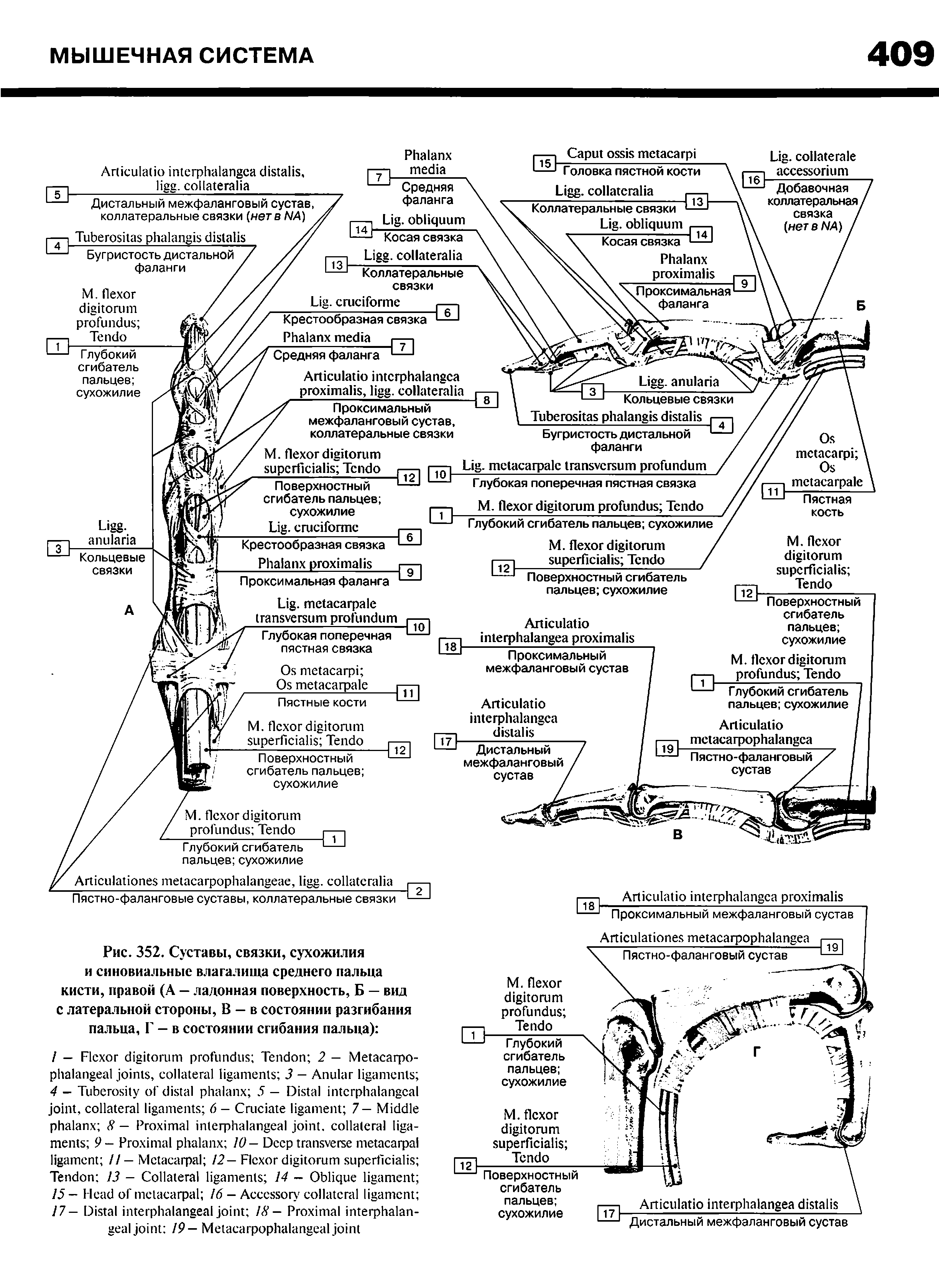 Рис. 352. Суставы, связки, сухожилия и синовиальные влагалища среднего пальца кисти, правой (А — ладонная поверхность, Б — вид с латеральной стороны, В — в состоянии разгибания пальца, Г — в состоянии сгибания пальца) ...