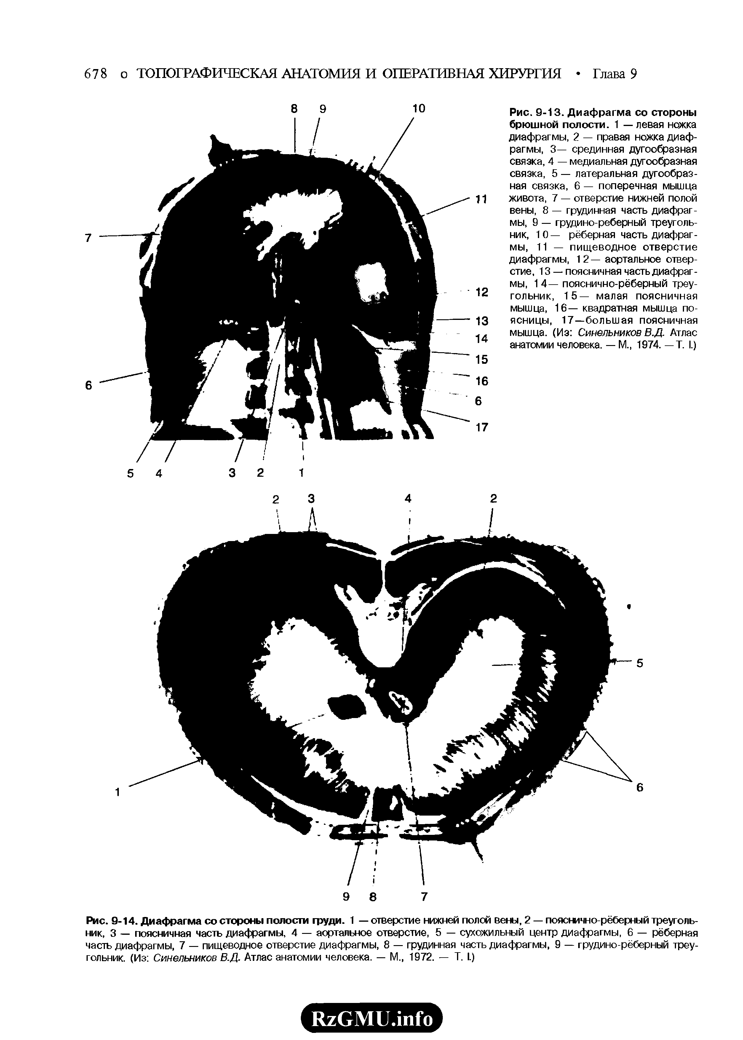 Рис. 9-14. Диафрагма со стороны полости груди. 1 — отверстие нижней полой вены, 2 — пояснично-рёберный треугольник, 3 — поясничная часть диафрагмы, 4 — аортальное отверстие, 5 — сухожильный центр диафрагмы, 6 — рёберная часть диафрагмы, 7 — пищеводное отверстие диафрагмы, 8 — грудинная часть диафрагмы, 9 — грудино-рёберный треугольник. (Из Синельников В.Д- Атлас анатомии человека. — М 1972. — Т. I.)...