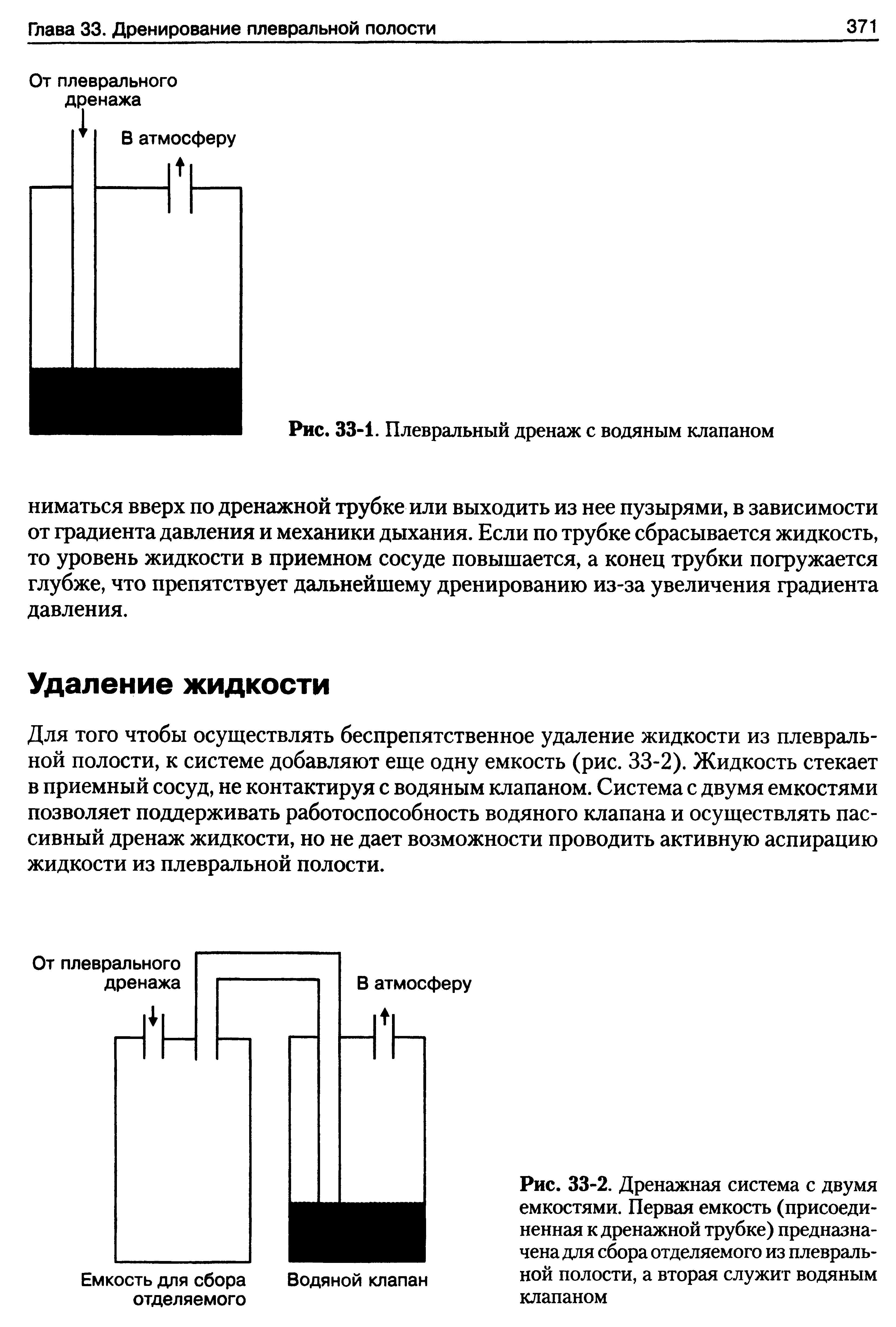 Рис. 33-2. Дренажная система с двумя емкостями. Первая емкость (присоединенная к дренажной трубке) предназначена для сбора отделяемого из плевральной полости, а вторая служит водяным клапаном...