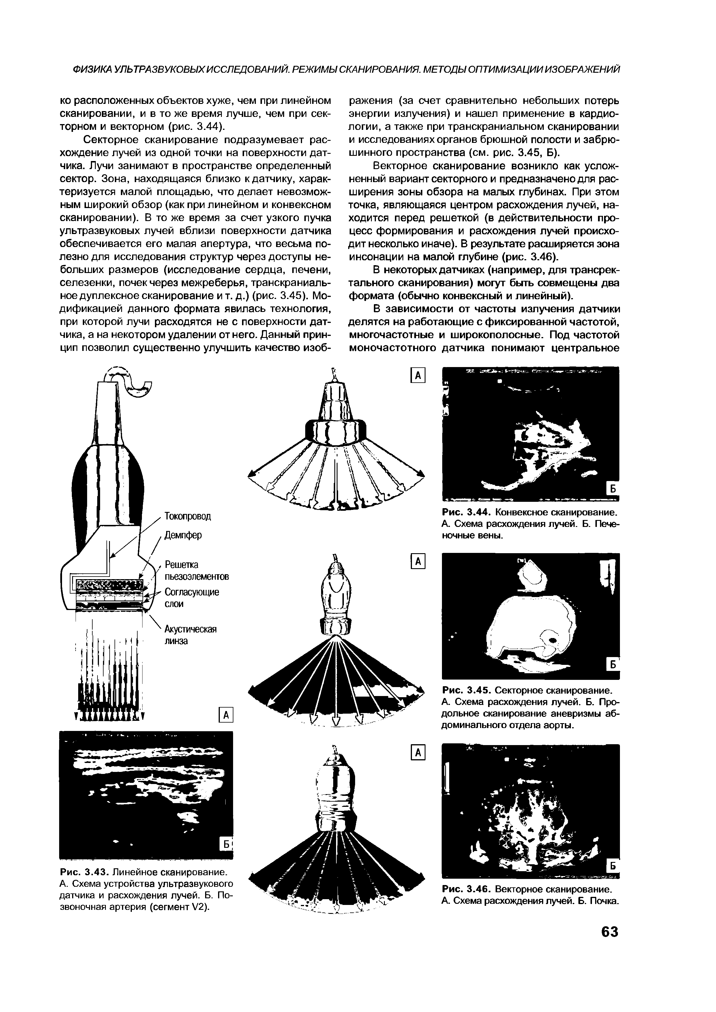 Рис. 3.45. Секторное сканирование. А. Схема расхождения лучей. Б. Продольное сканирование аневризмы абдоминального отдела аорты.