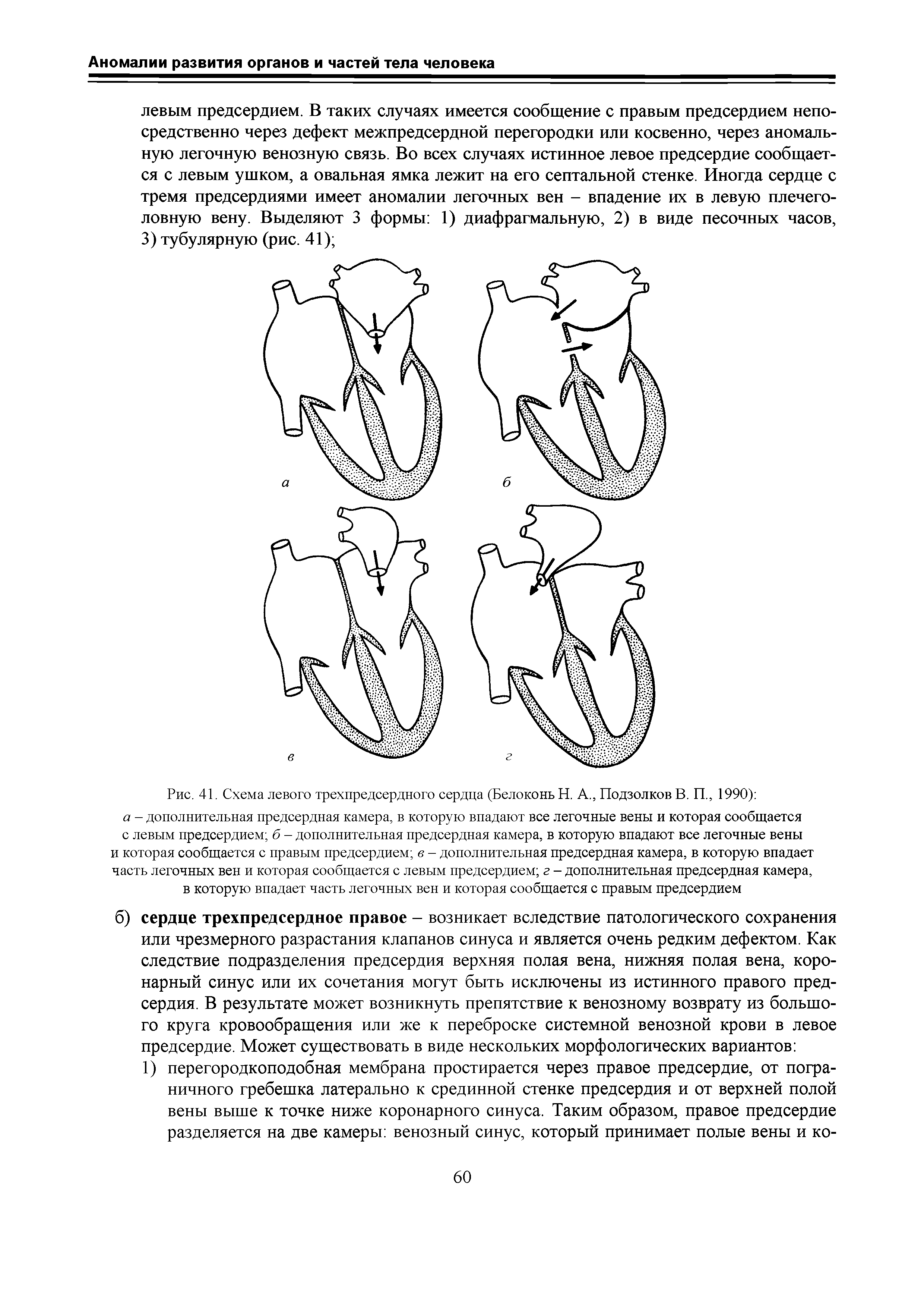 Рис. 41. Схема левого трехпредсердного сердца (Белоконь Н. А., Подзолков В. П., 1990) ...