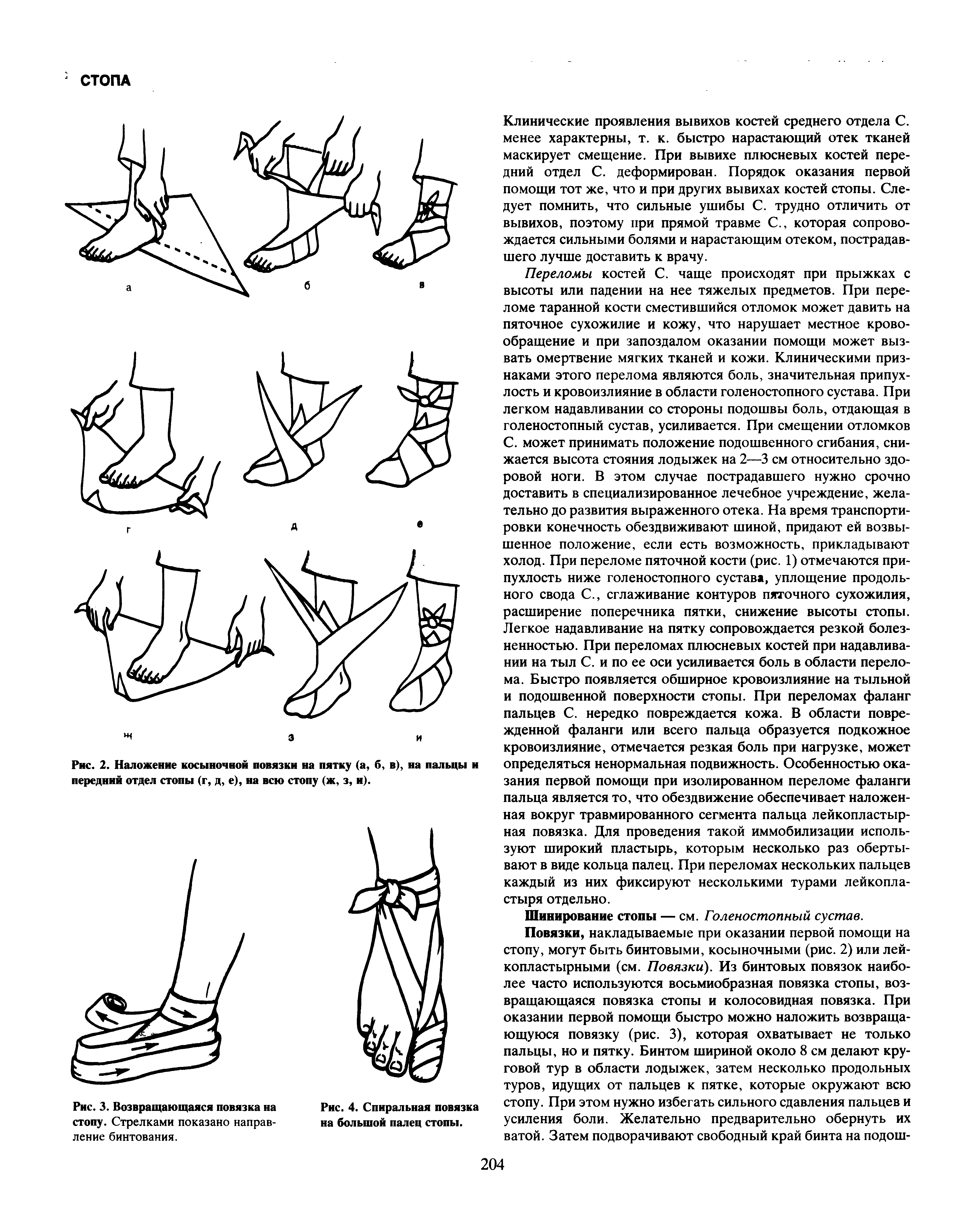 Рис. 2. Наложение косыночной повязки на пятку (а, б, в), на пальцы и передний отдел стопы (г, д, е), на всю стопу (ж, з, и).