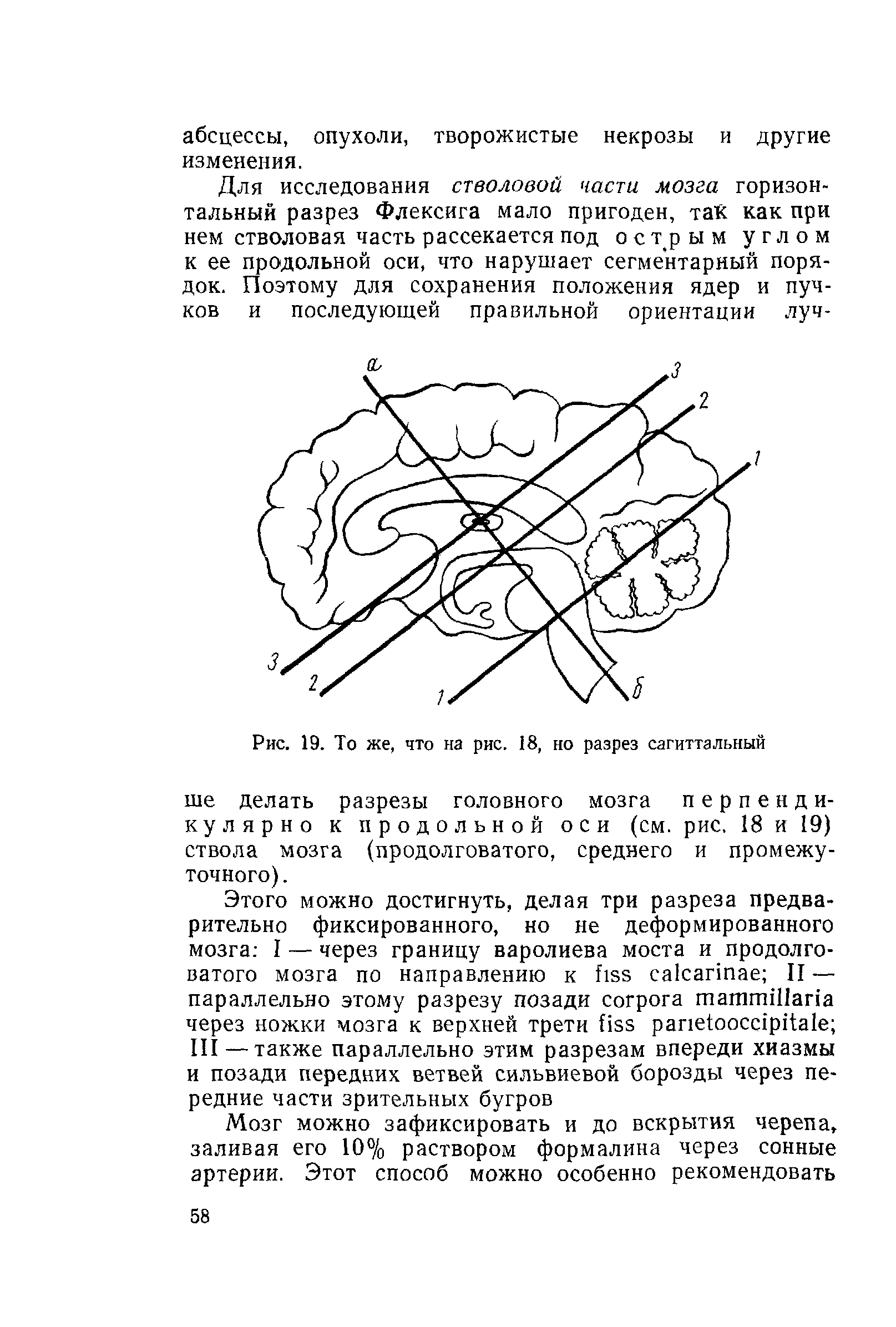 Рис. 19. То же, что на рис. 18, но разрез сагиттальный ше делать разрезы головного мозга перпендикулярно к продольной оси (см. рис. 18 и 19) ствола мозга (продолговатого, среднего и промежуточного). ...