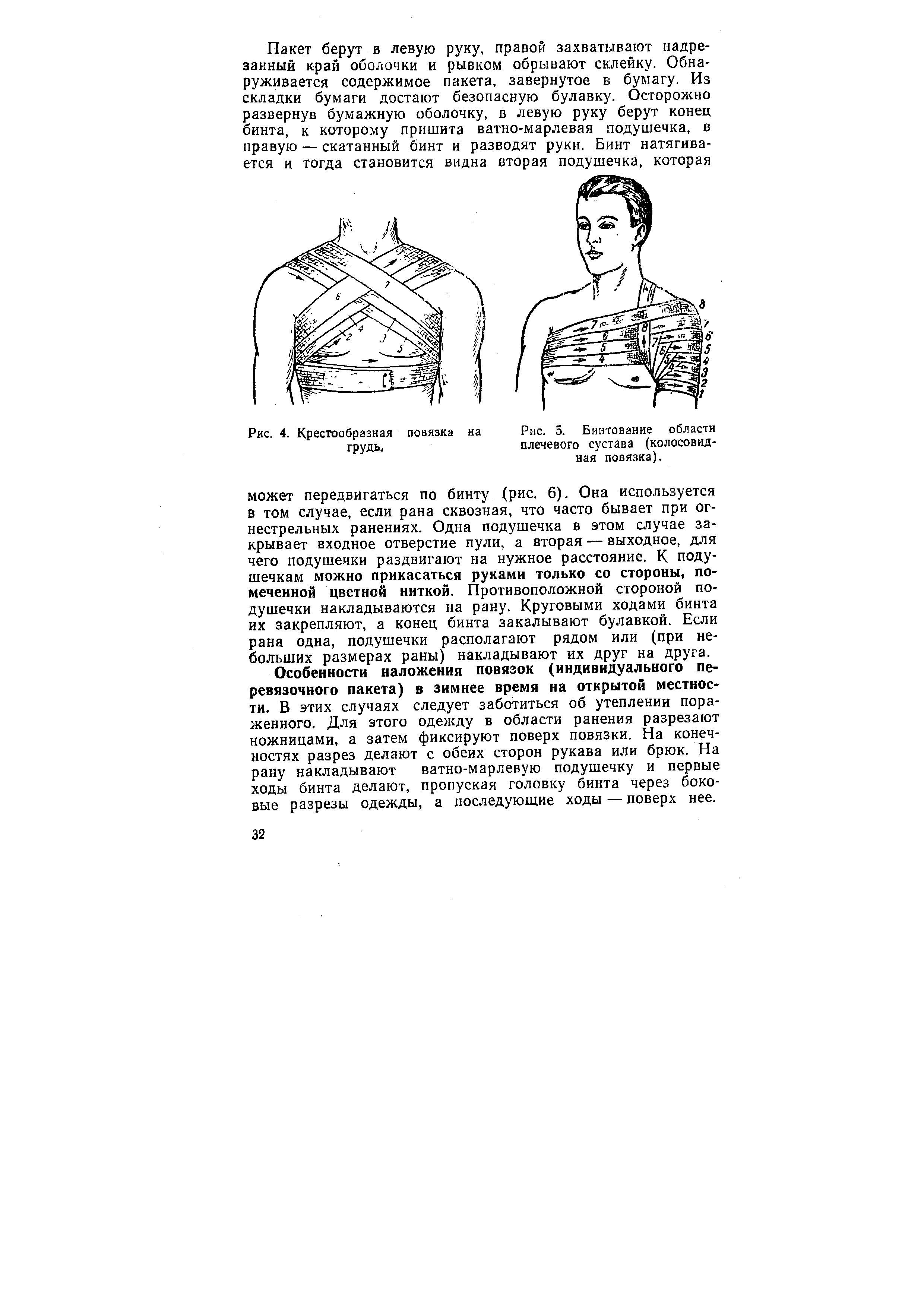 Рис. 5. Бинтование области плечевого сустава (колосовидная повязка).