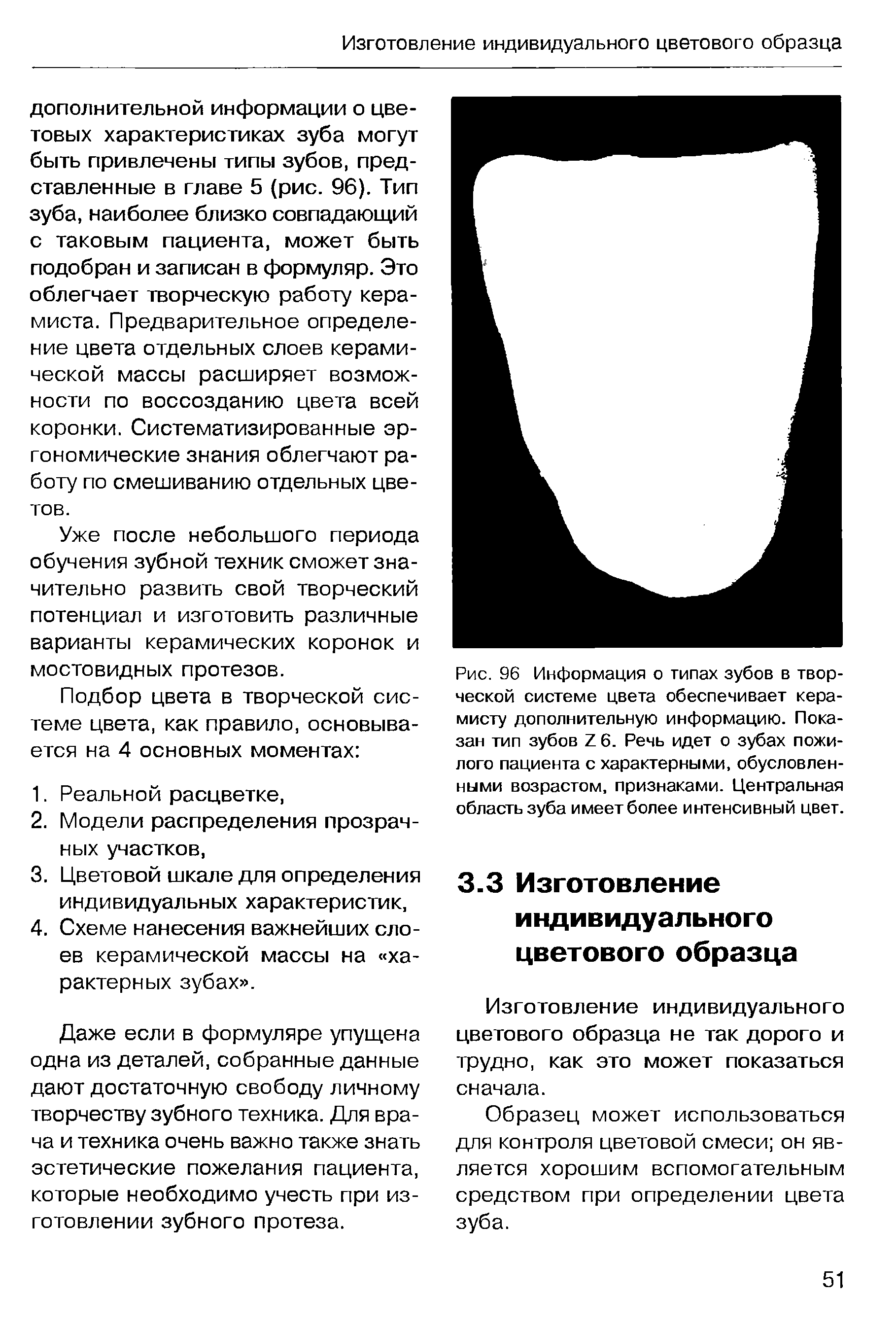 Рис. 96 Информация о типах зубов в творческой системе цвета обеспечивает керамисту дополнительную информацию. Показан тип зубов 76. Речь идет о зубах пожилого пациента с характерными, обусловленными возрастом, признаками. Центральная область зуба имеет более интенсивный цвет.