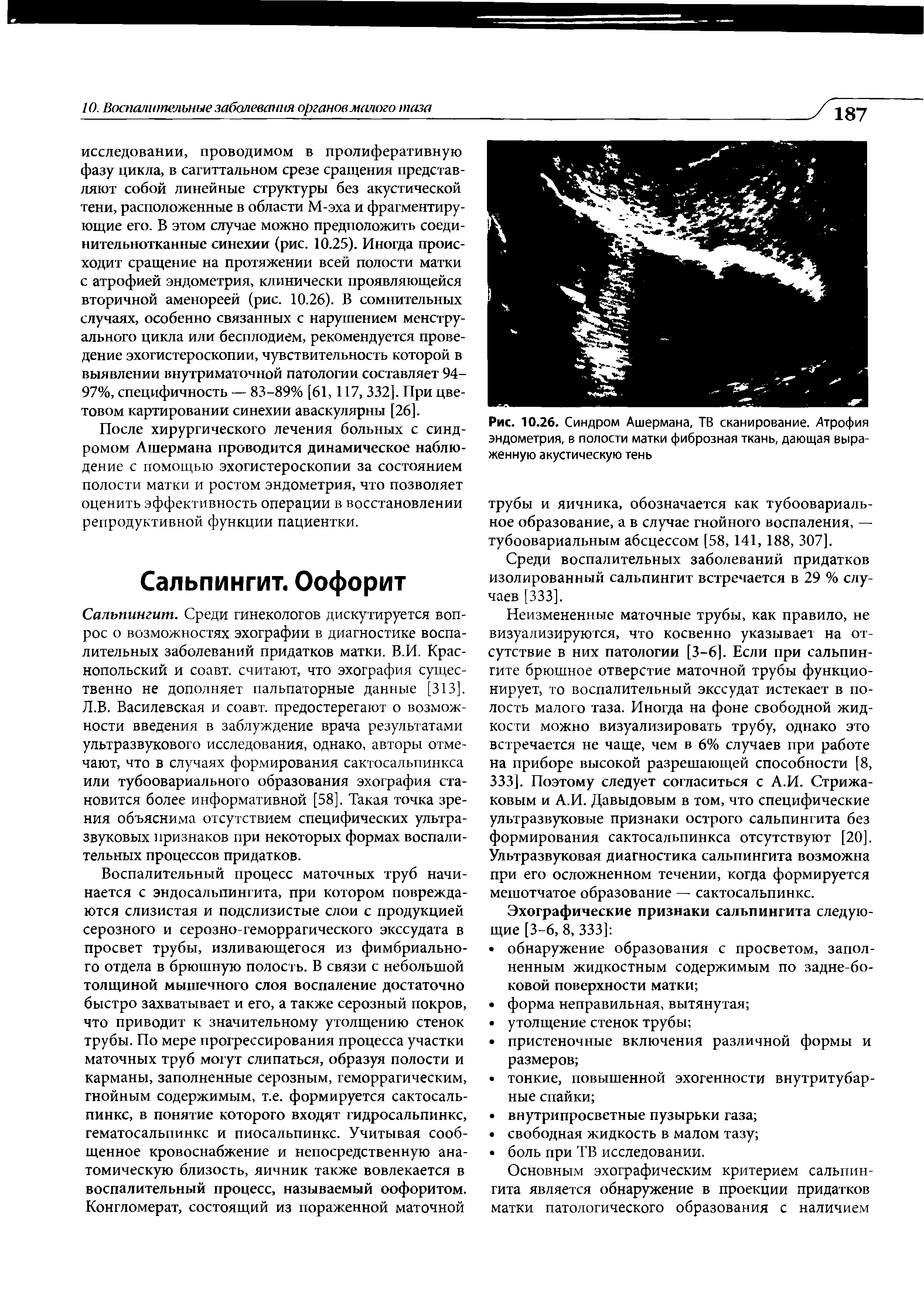 Рис. 10.26. Синдром Ашермана, ТВ сканирование. Атрофия эндометрия, в полости матки фиброзная ткань, дающая выраженную акустическую тень...