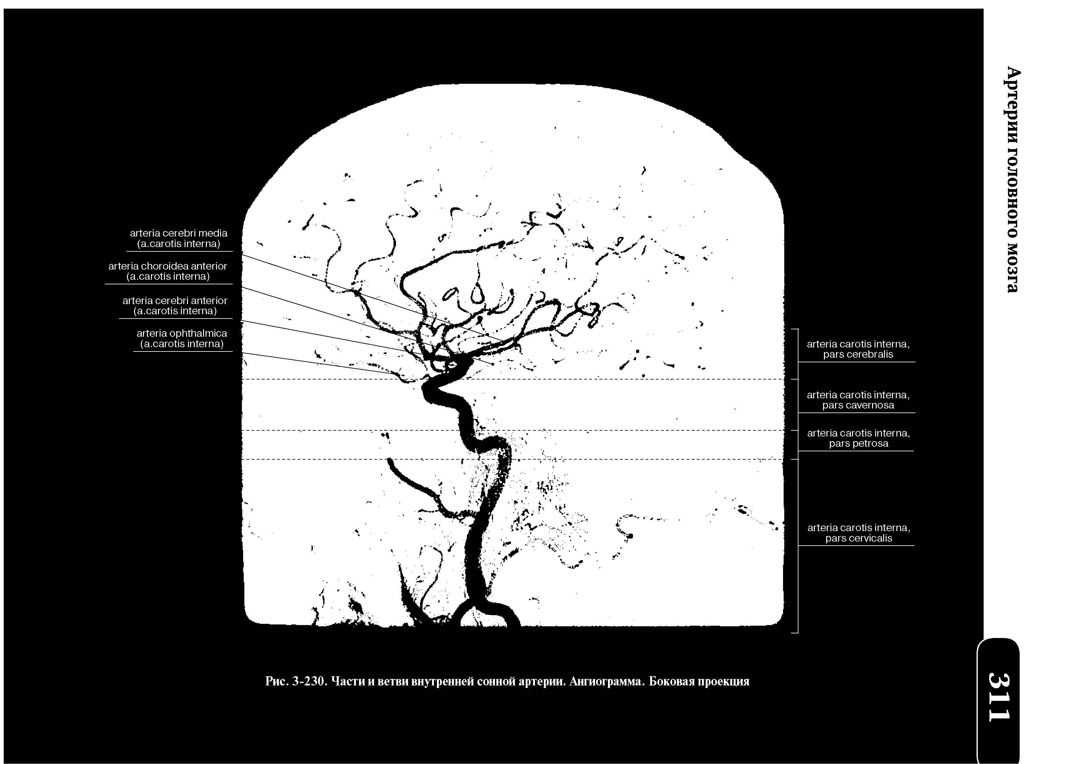 Рис. 3-230. Части и ветви внутренней сонной артерии. Ангиограмма. Боковая проекция...