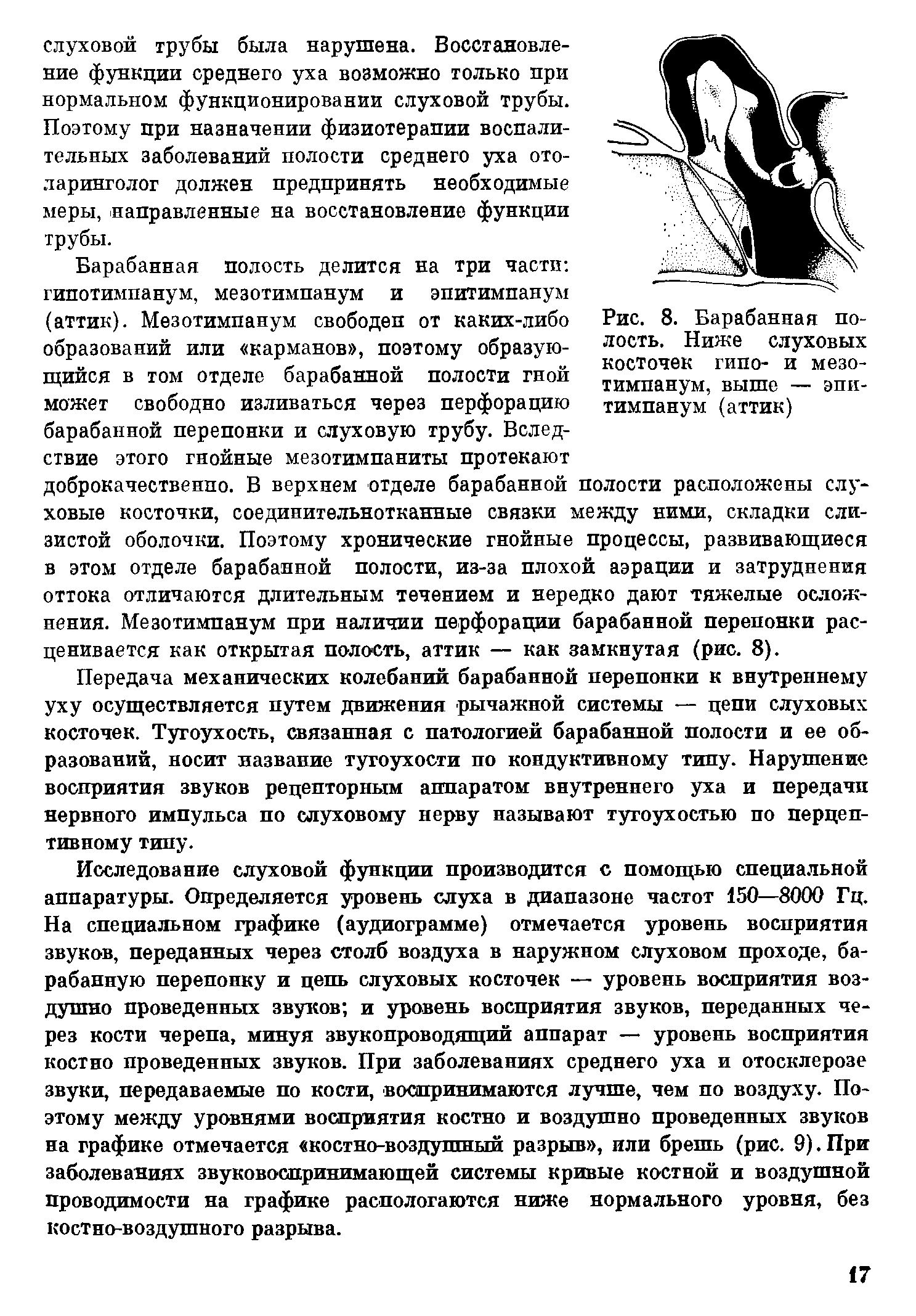 Рис. 8. Барабанная полость. Ниже слуховых косточек гипо- и мезотимпанум, выше — эпитимпанум (аттик)...