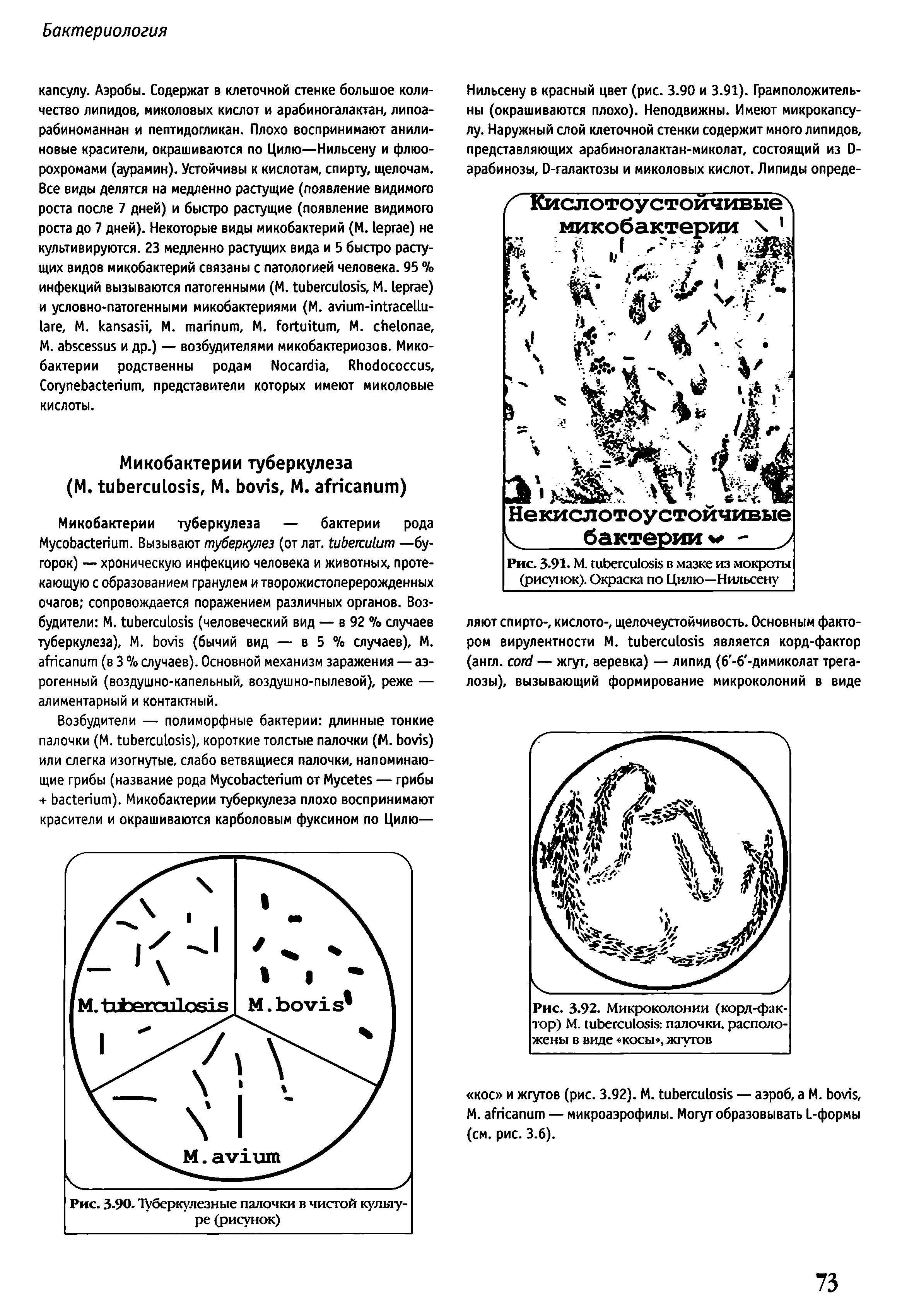 Рис. 3.92. Микроколонии (корд-фактор) М. палочки, расположены в виде косы , жгутов...