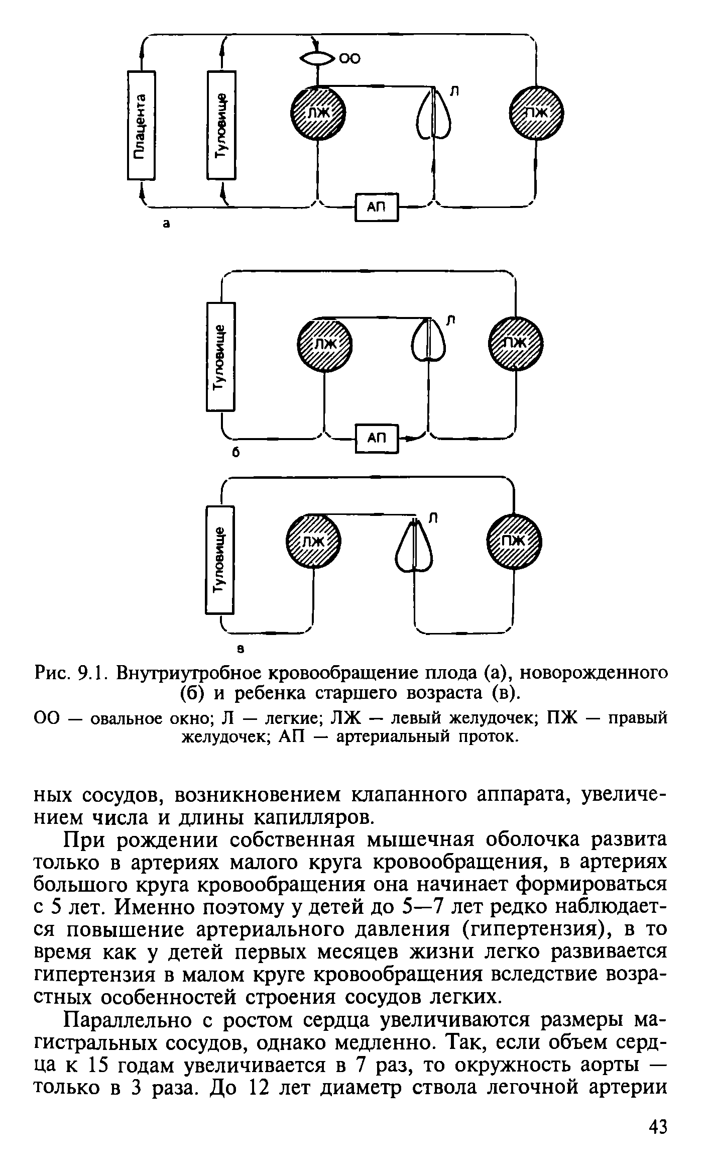 Рис. 9.1. Внутриутробное кровообращение плода (а), новорожденного (б) и ребенка старшего возраста (в).