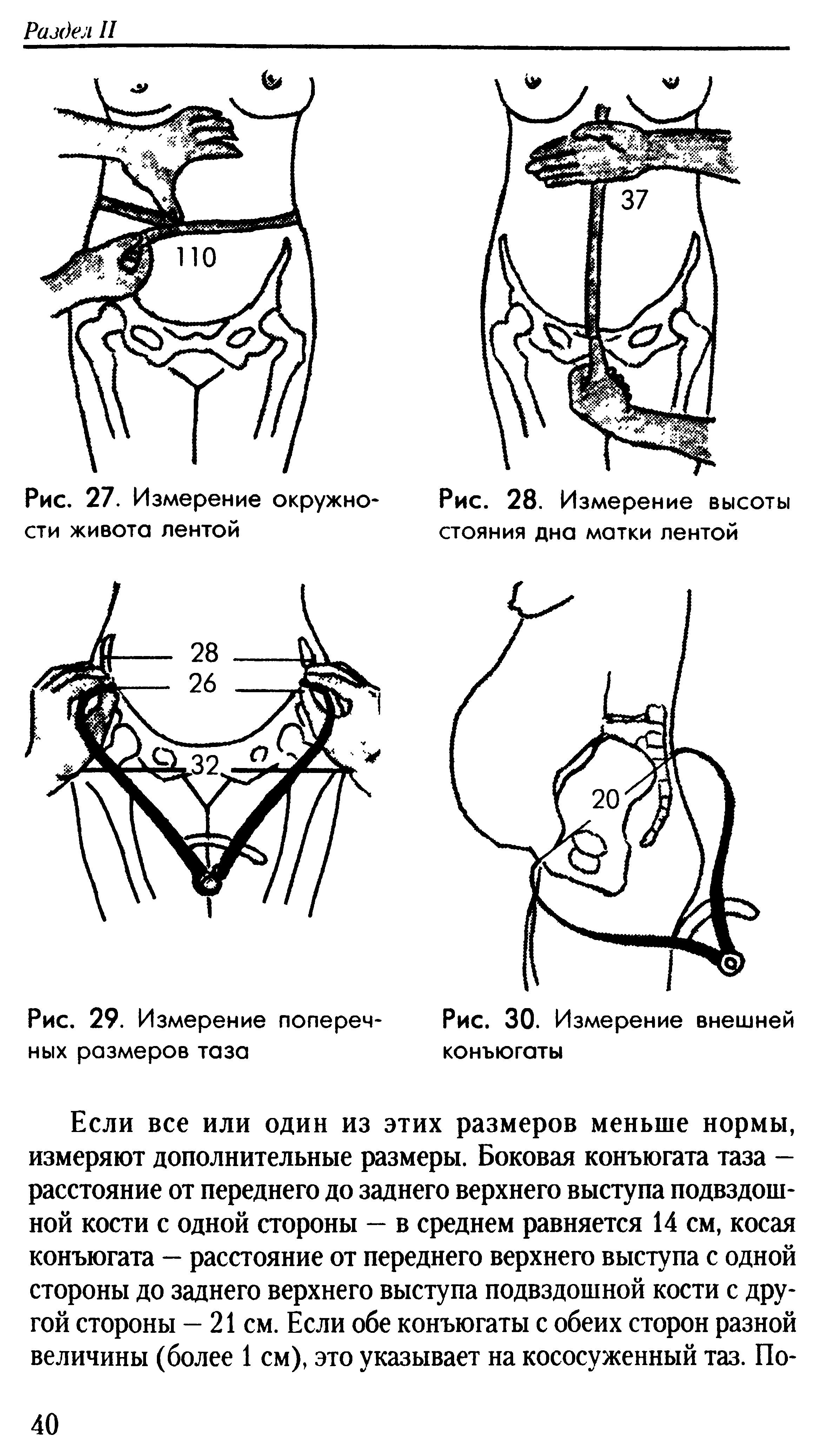 Как измерить живот при беременности. Измерение высоты дна матки беременной. Высота стояния дна матки по неделям беременности. Измерение высоты стояния дна матки у беременной. Высоту дна матки измеряют:.