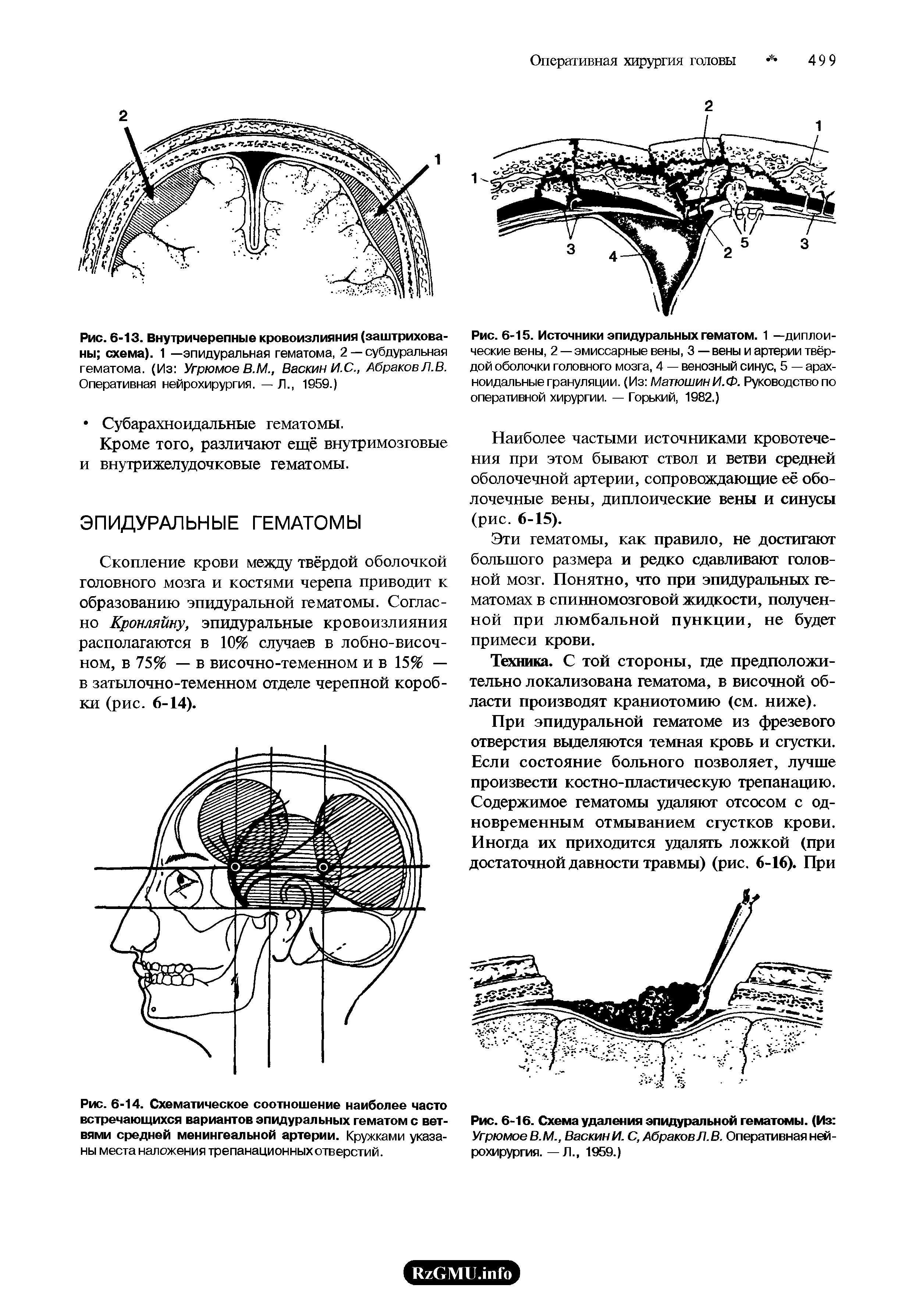 Рис. 6-15. Источники эпидуральных гематом. 1 —диплоические вены, 2 — эмиссарные вены, 3 — вены и артерии твёрдой оболочки головного мозга, 4 — венозный синус, 5 — арахноидальные грануляции. (Из МатюшинИ.Ф. Руководство по оперативной хирургии. — Горький, 1982.)...