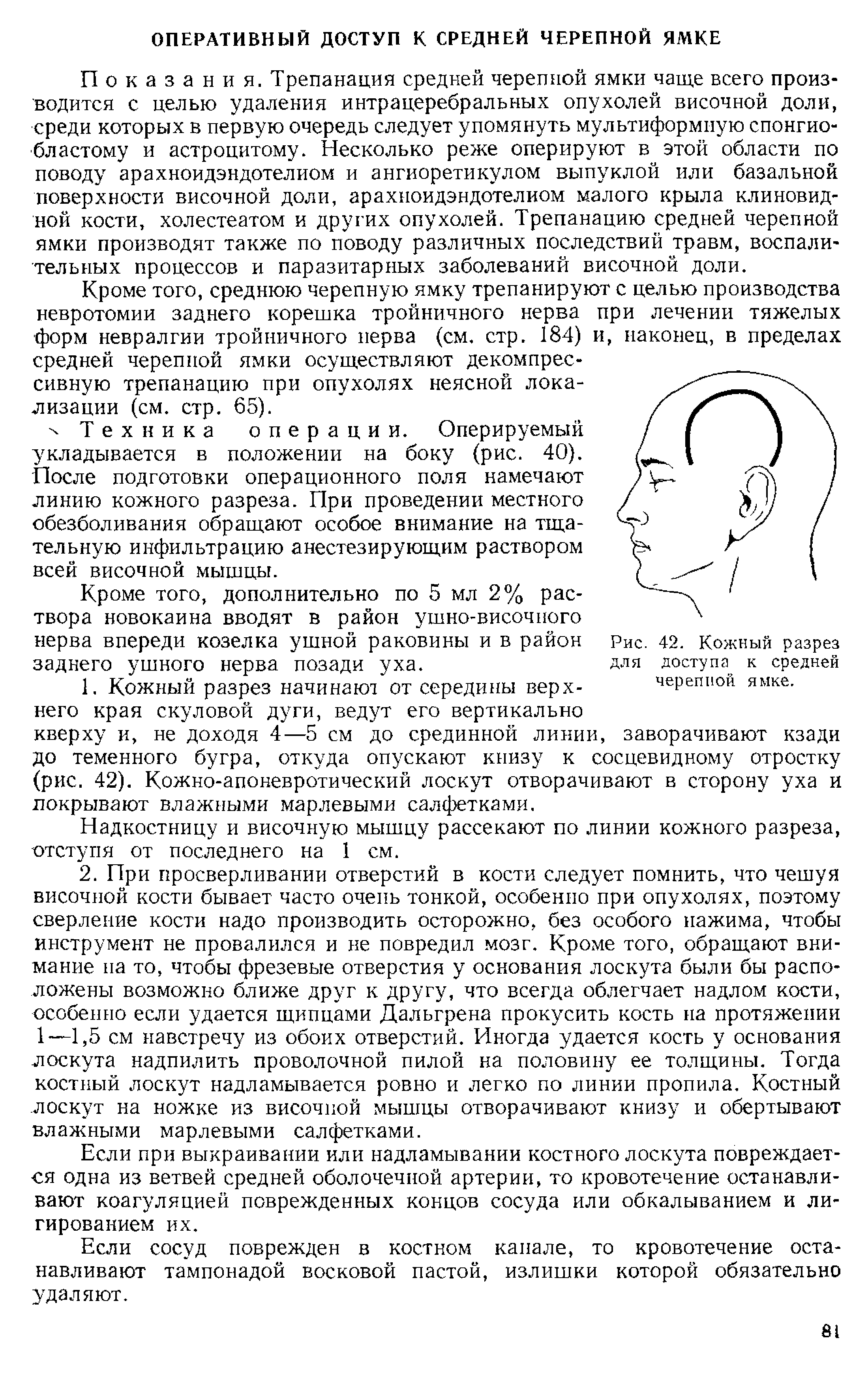 Рис. 42. Кожный разрез для доступа к средней черепной ямке.