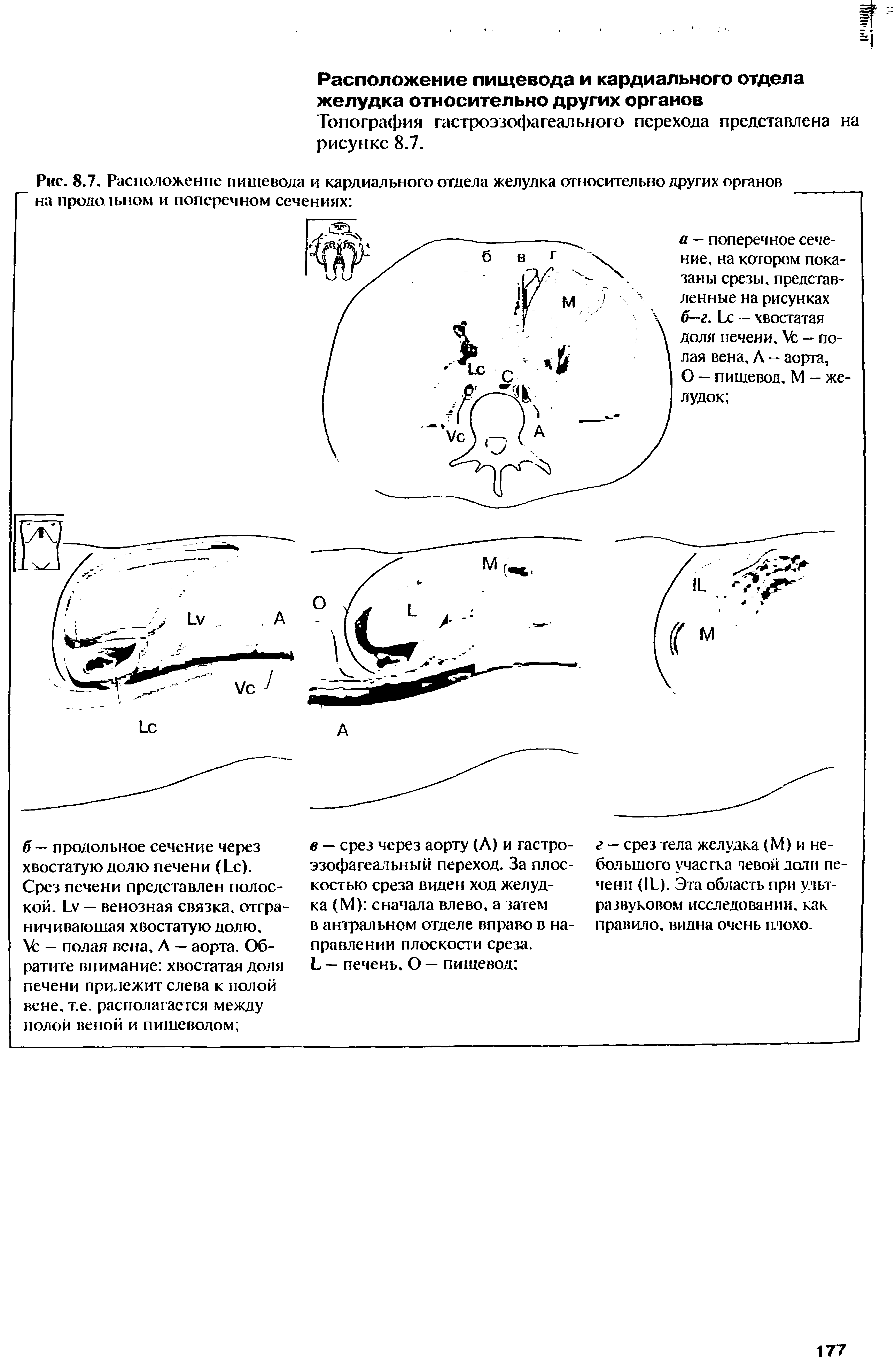 Рис. 8.7. Расположение пищевода и кардиального отдела желудка относительно других органов на продольном и поперечном сечениях ...