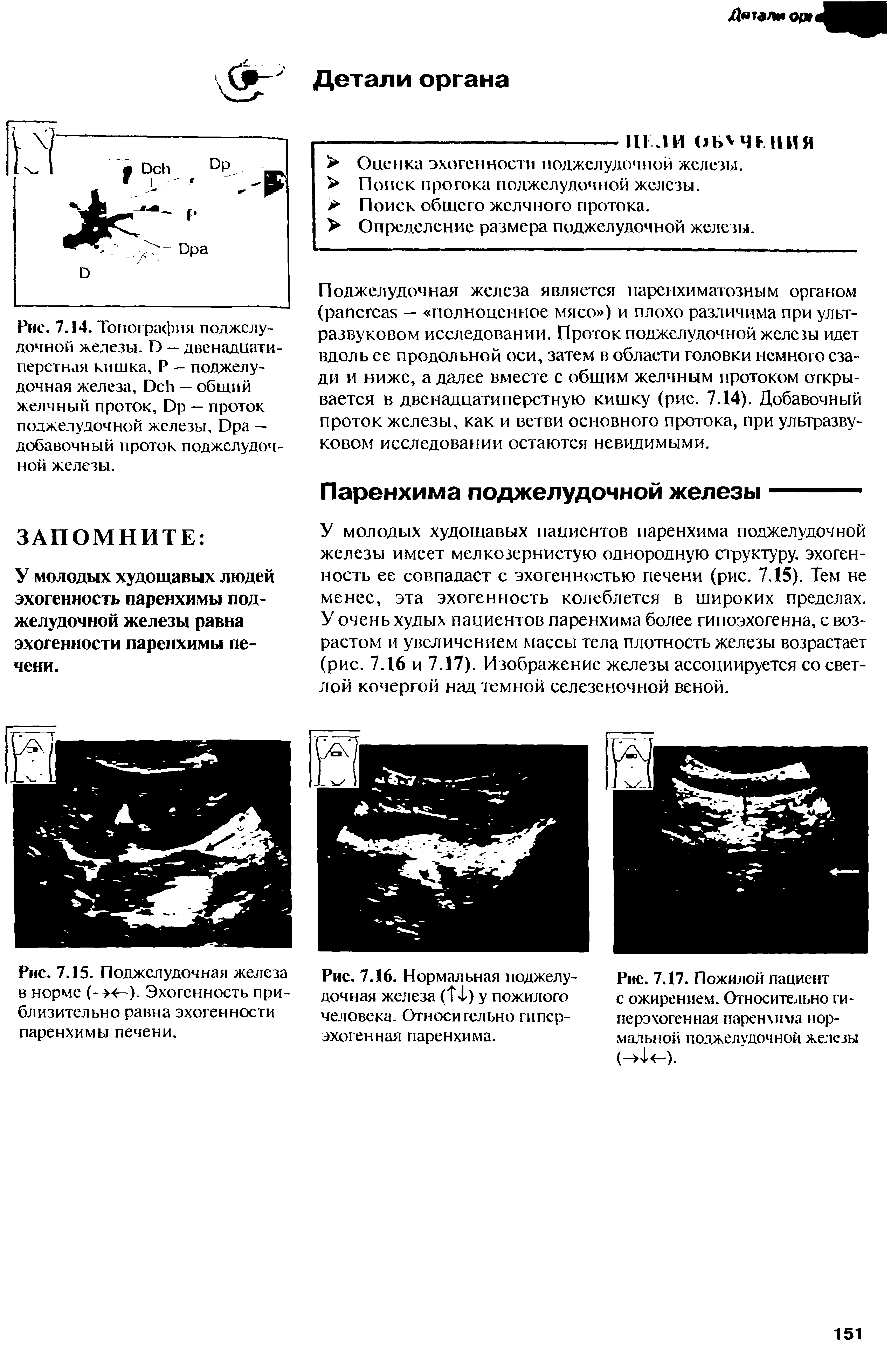 Рис. 7.14. Топография поджелудочной железы. D — двенадцатиперстная кишка, Р — поджелудочная железа, D — общий желчный проток, D — проток поджелудочной железы. D — добавочный проток поджелудочной железы.