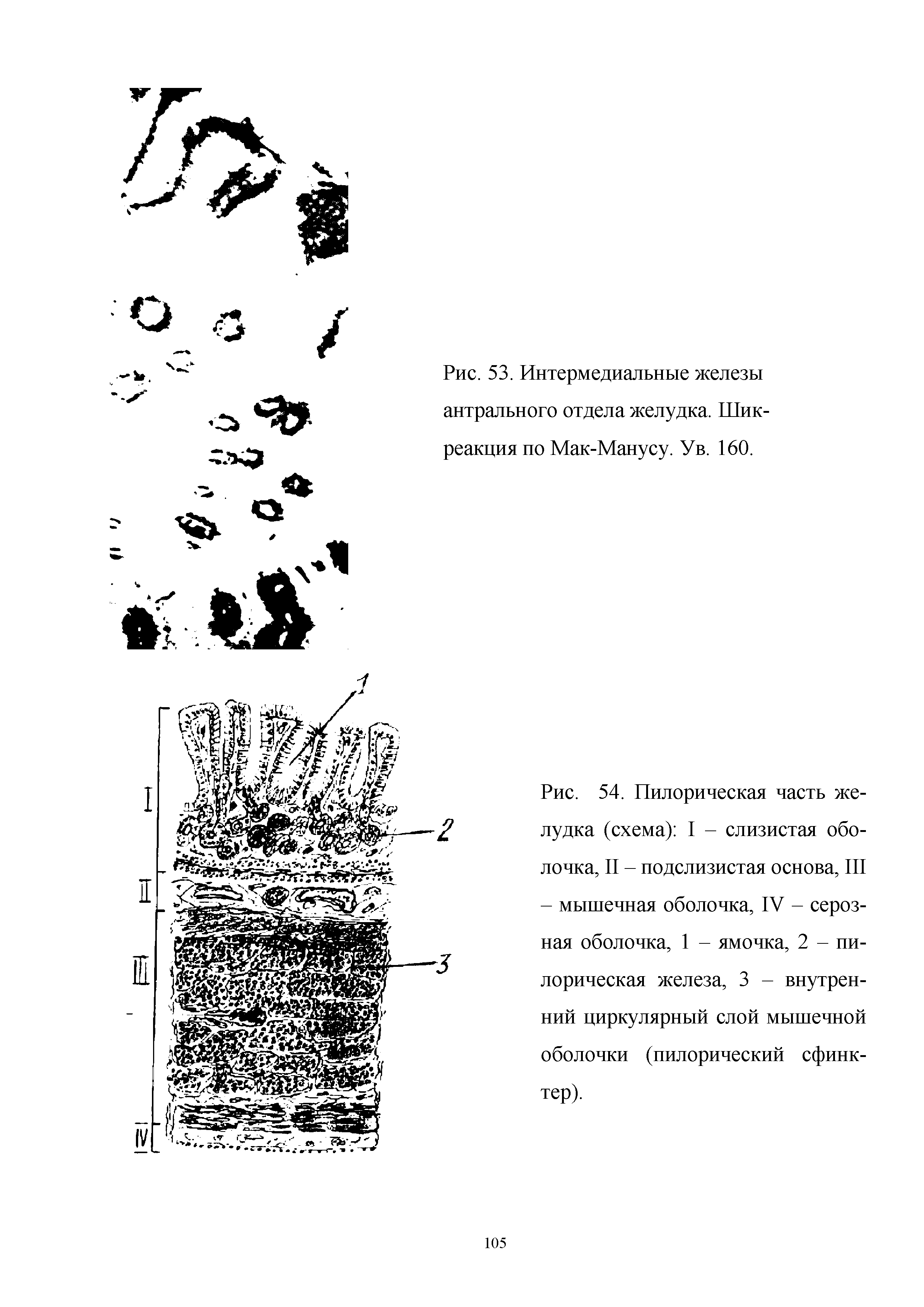 Рис. 53. Интермедиальные железы антрального отдела желудка. Шик-реакция по Мак-Манусу. Ув. 160.