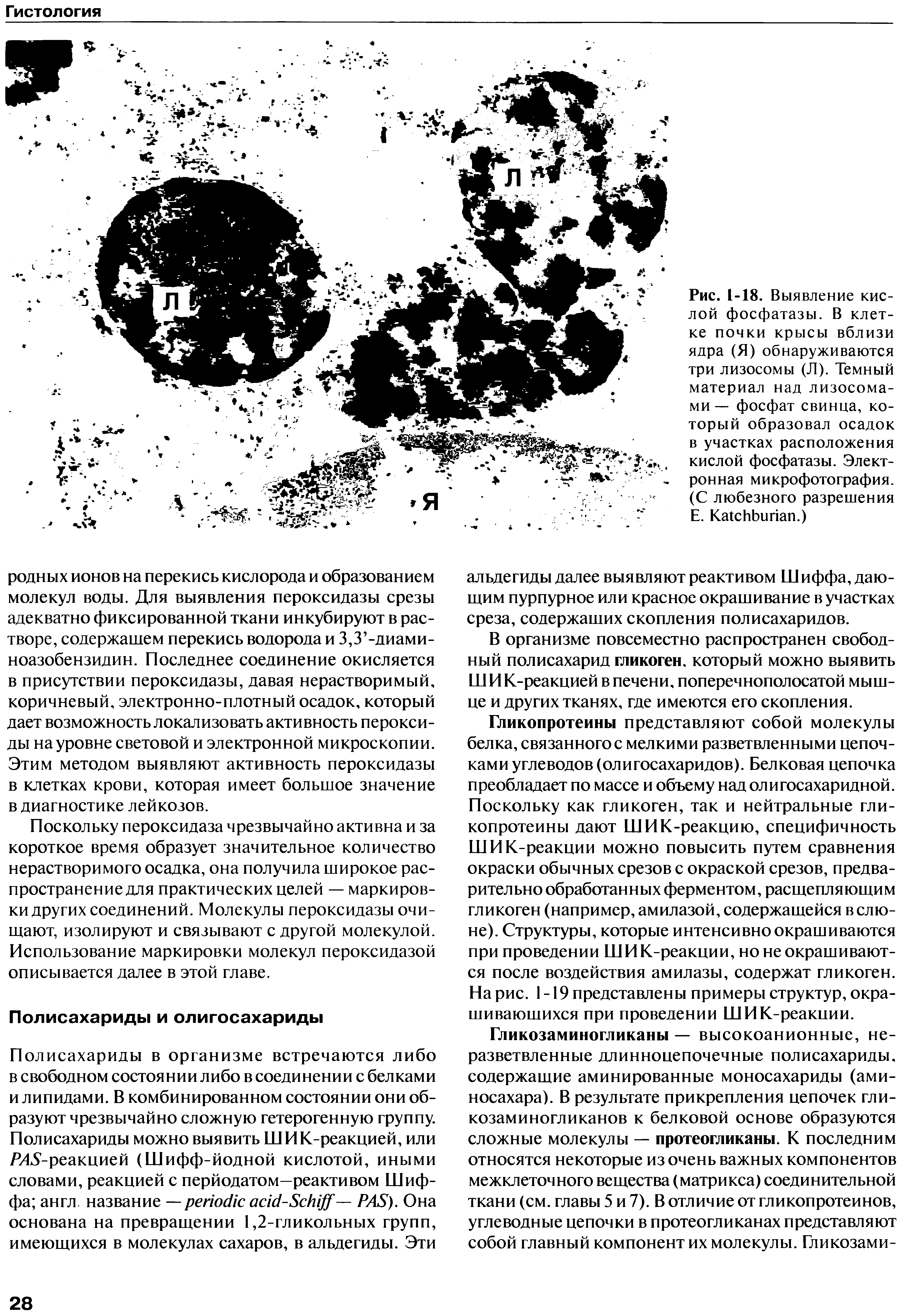 Рис. 1-18. Выявление кислой фосфатазы. В клетке почки крысы вблизи ядра (Я) обнаруживаются три лизосомы (Л). Темный материал над лизосомами — фосфат свинца, который образовал осадок в участках расположения кислой фосфатазы. Электронная микрофотография. (С любезного разрешения Е. КакЩЬипап.)...