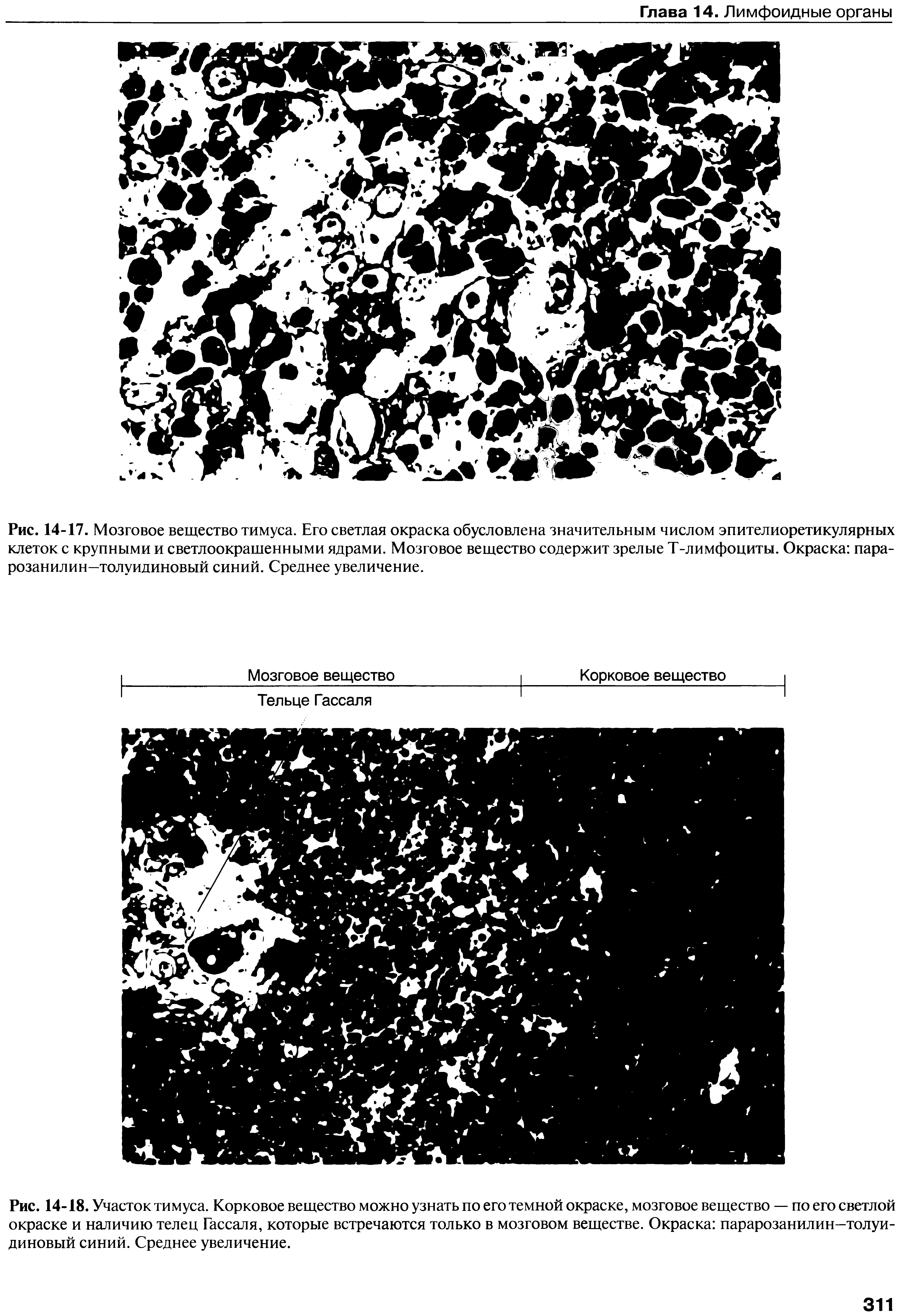 Рис. 14-18. Участок тимуса. Корковое вещество можно узнать по его темной окраске, мозговое вещество — по его светлой окраске и наличию телец Гассаля, которые встречаются только в мозговом веществе. Окраска парарозанилин—толуидиновый синий. Среднее увеличение.