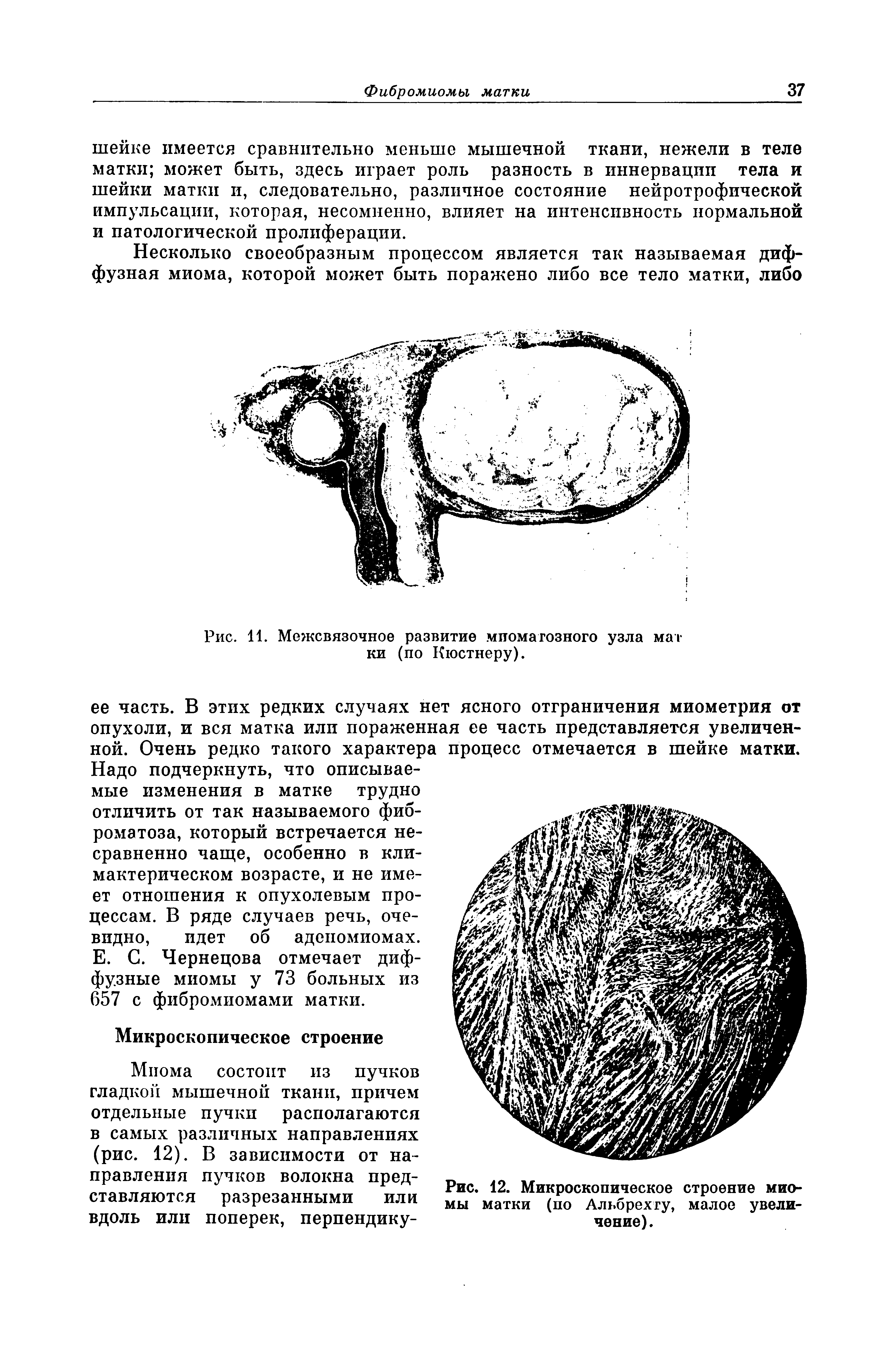 Рис. 12. Микроскопическое строение миомы матки (по Альбрехту, малое увеличение).