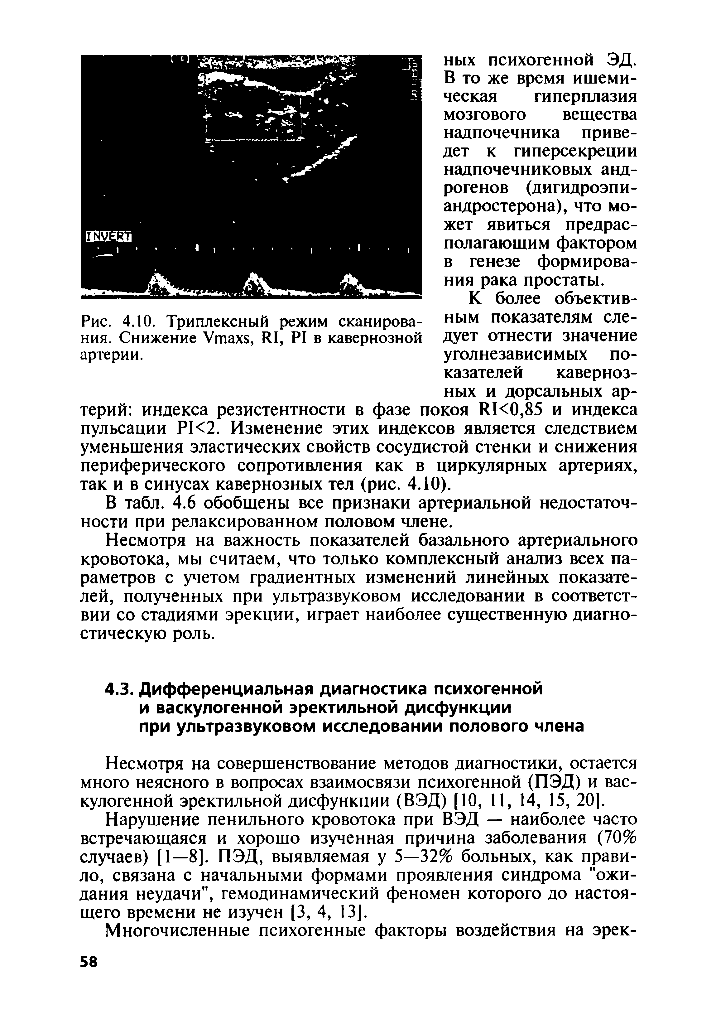 Рис. 4.10. Триплексный режим сканирова- ным показателям едения. Снижение УтахБ, И1, Р1 в кавернозной дует отнести значение артерии. уголнезависимых по-...