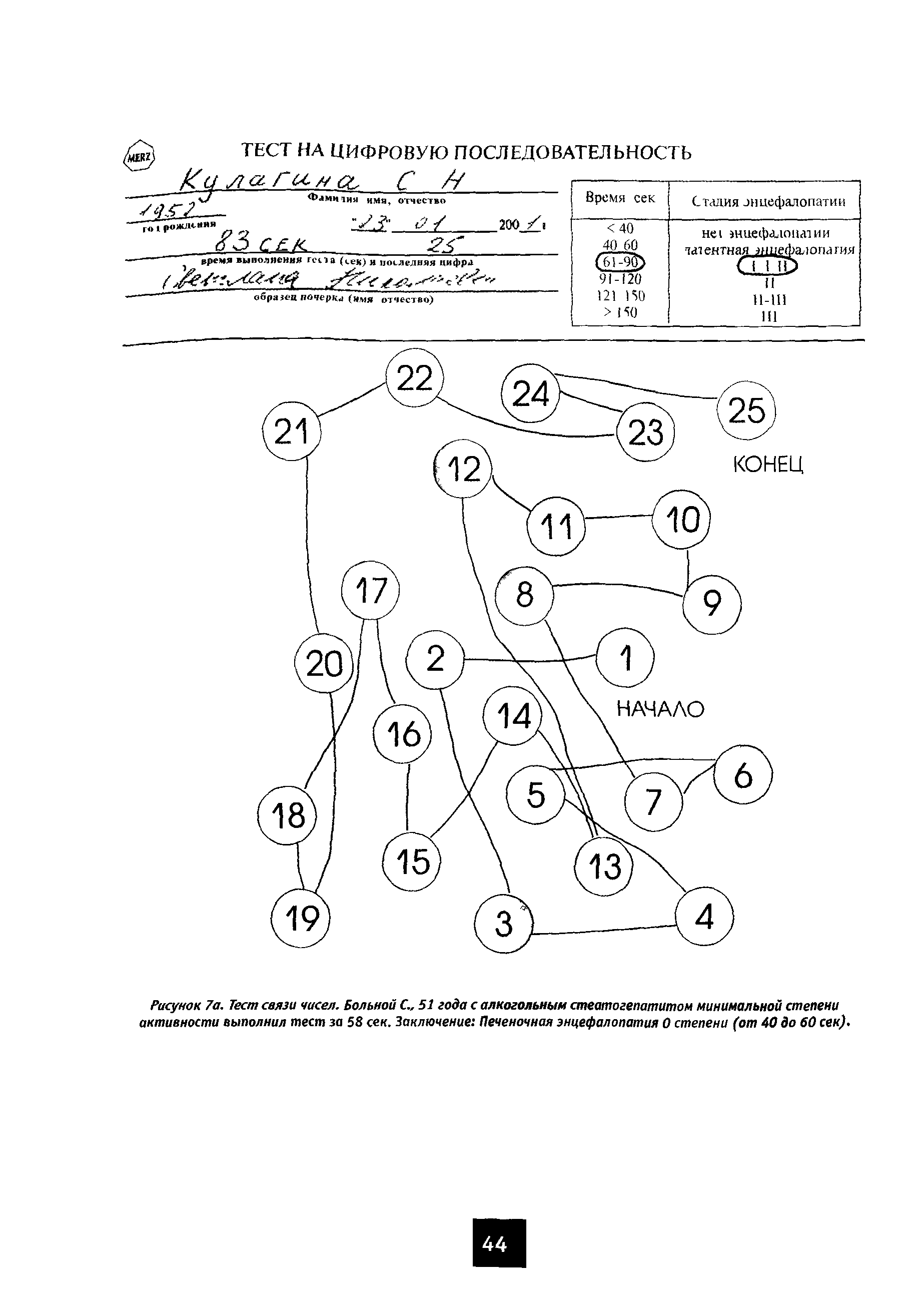 Рисунок 7а. Тест связи чисел. Больной С 51 года с алкогольным стеатогепатитом минимальной степени активности выполнил тест за 58 сек. Заключение Печеночная энцефалопатия 0 степени (от 40 до 60 сек) ...