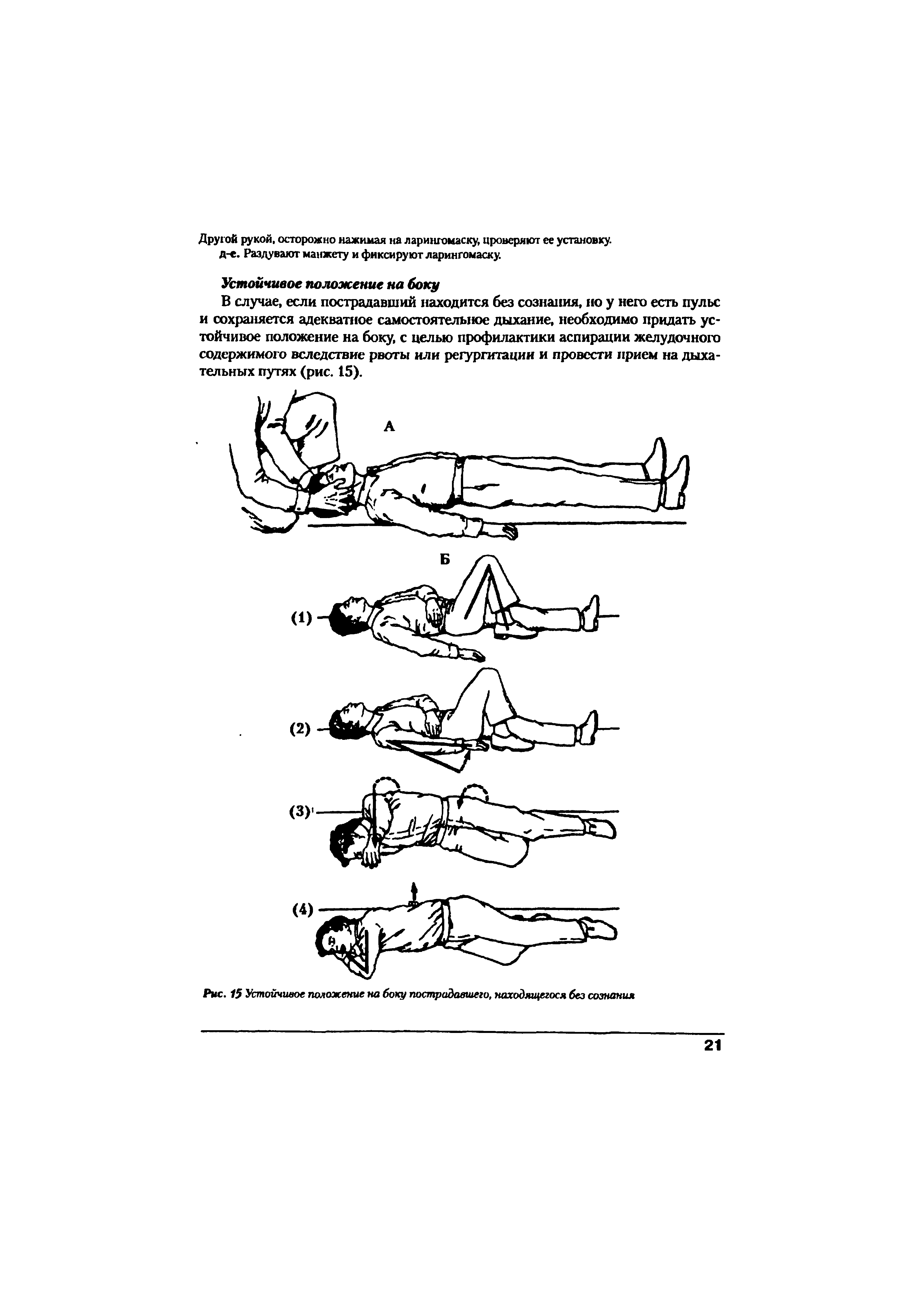 Рис. /5 Устойчивое положение на боку пострадавшего, находящегося без сознания...