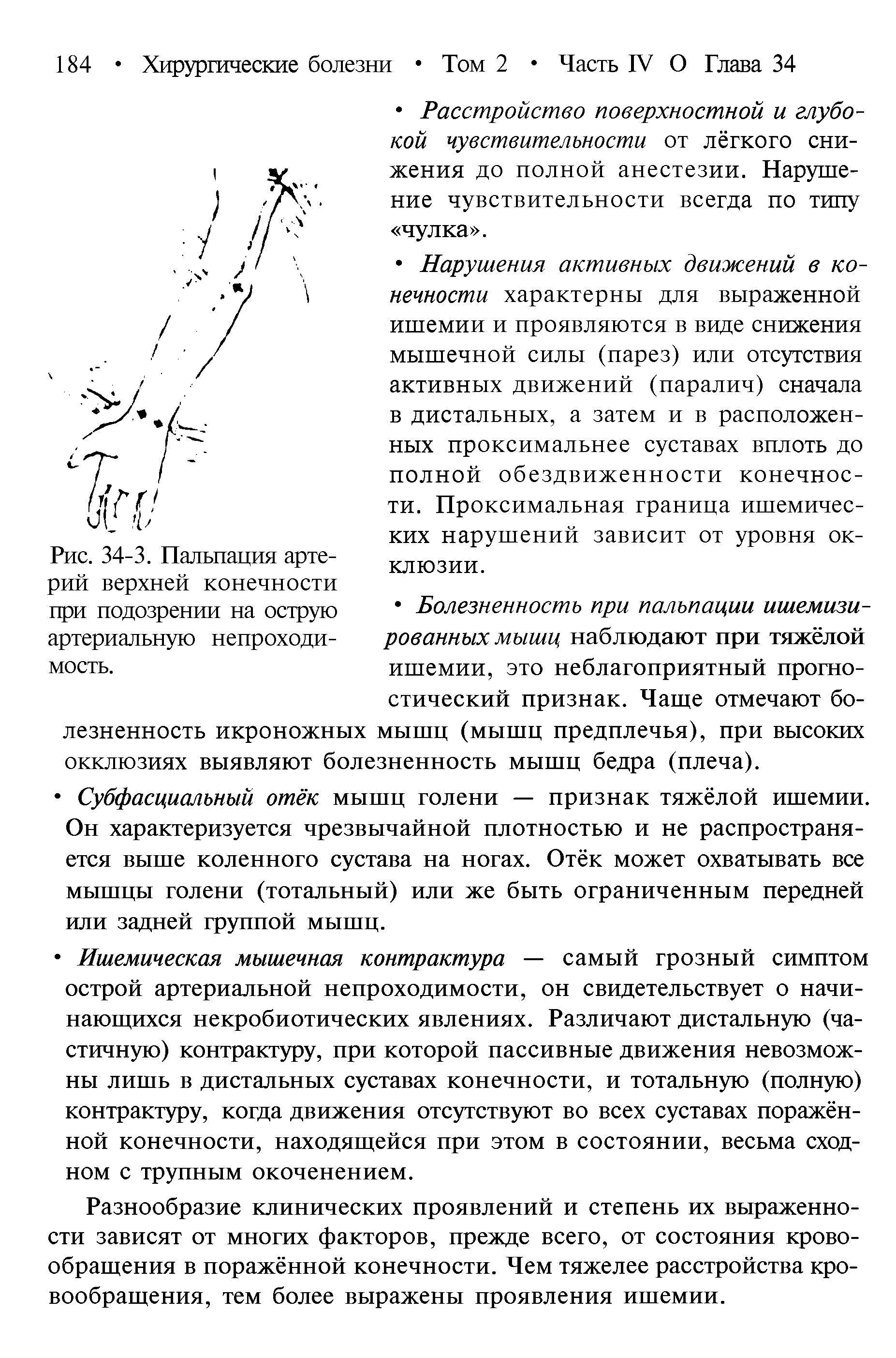 Рис. 34-3. Пальпация артерий верхней конечности при подозрении на острую артериальную непроходимость.