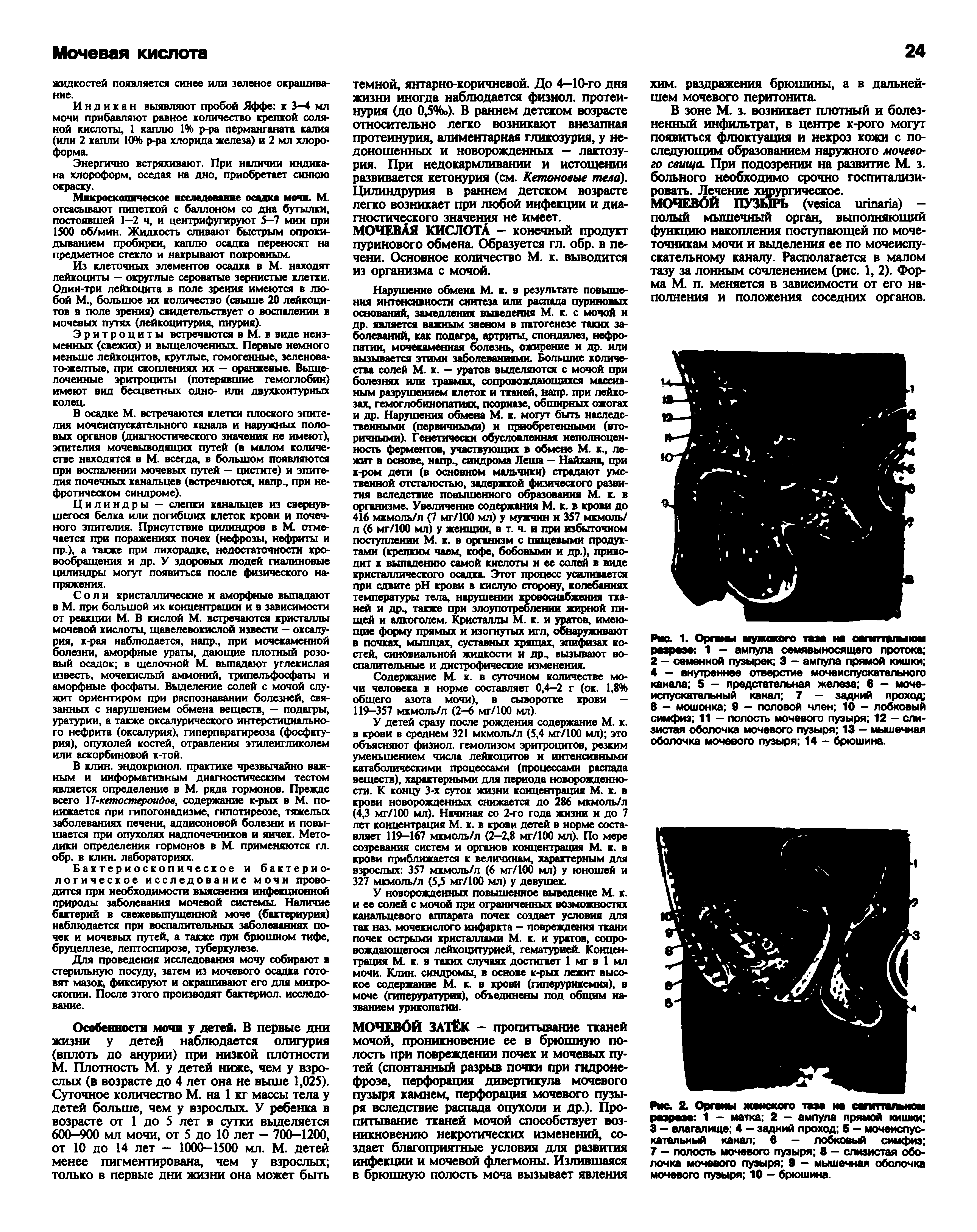 Рис. 1. Органы мужского таза на саппталыюм разрезе 1 - ампула семявыносящего протока 2 — семенной пузырек 3 — ампула прямой кишки 4 - внутреннее отверстие мочеиспускательного канала 5 — предстательная железа 6 — мочеиспускательный канал 7 - задний проход 8 - мошонка 9 - половой член 10 - лобковый симфиз 11 — полость мочевого пузыря 12 — слизистая оболочка мочевого пузыря 13 - мышечная оболочка мочевого пузыря 14 — брюшина.